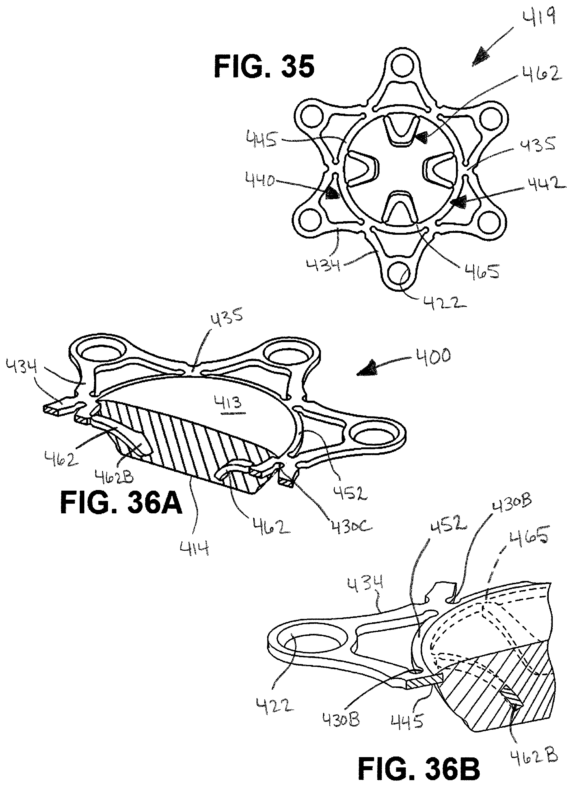Patent US12508054 Figure 14 – Implants for filling bore holes in bone and methods for filling bore holes in bone