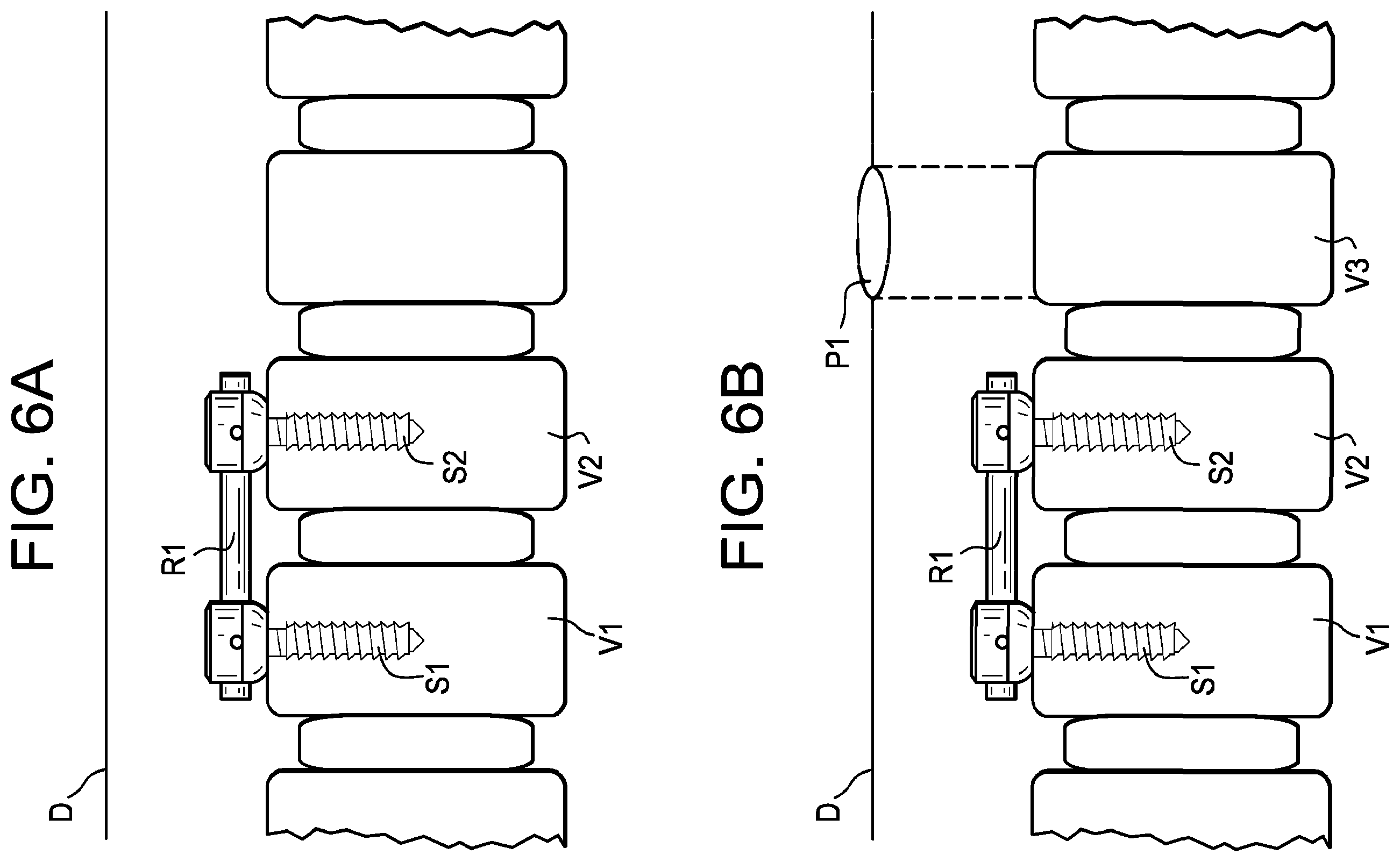 Patent US12508055 Figure 16 – Spinal connectors and related methods
