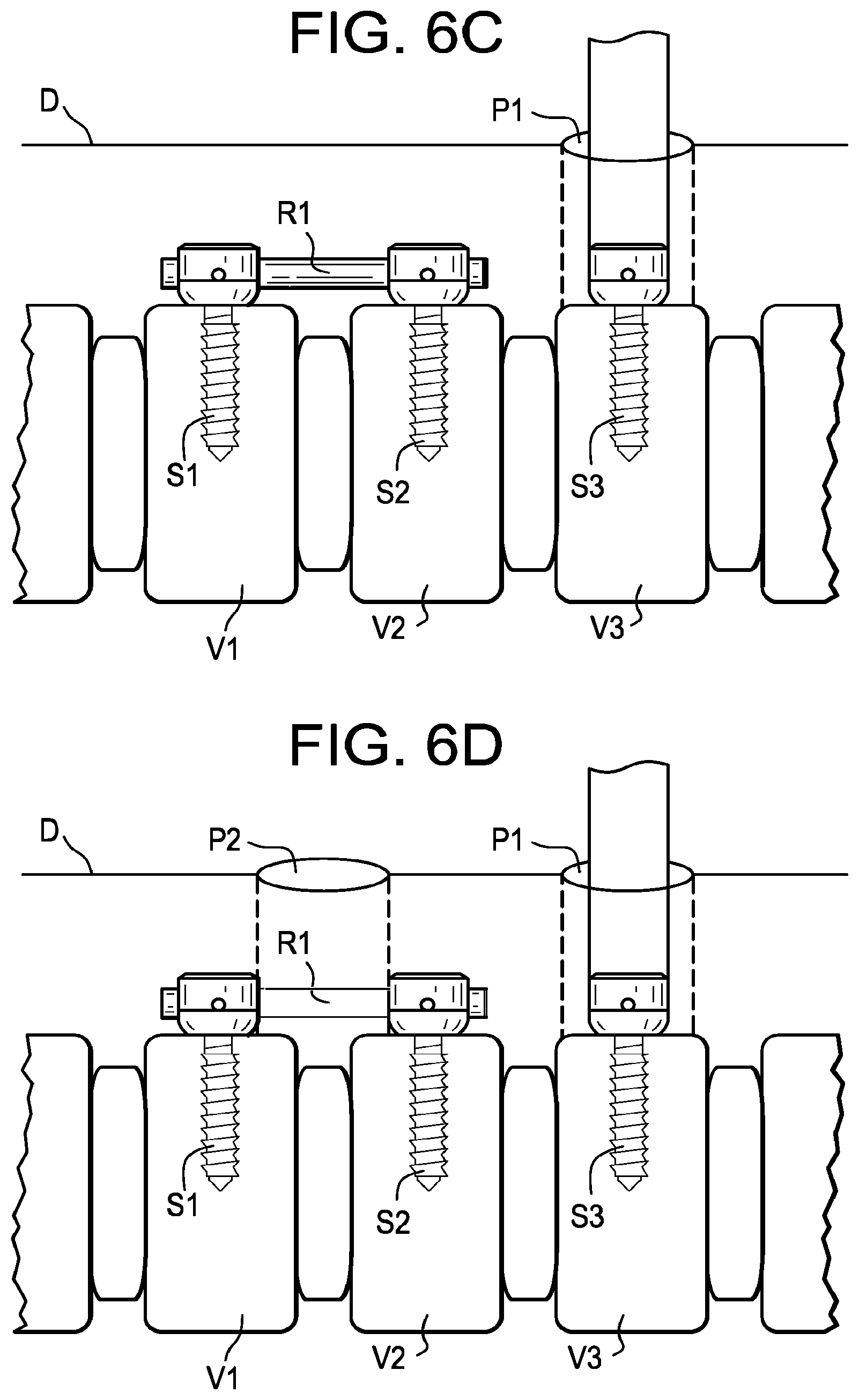 Patent US12508055 Figure 17 – Spinal connectors and related methods