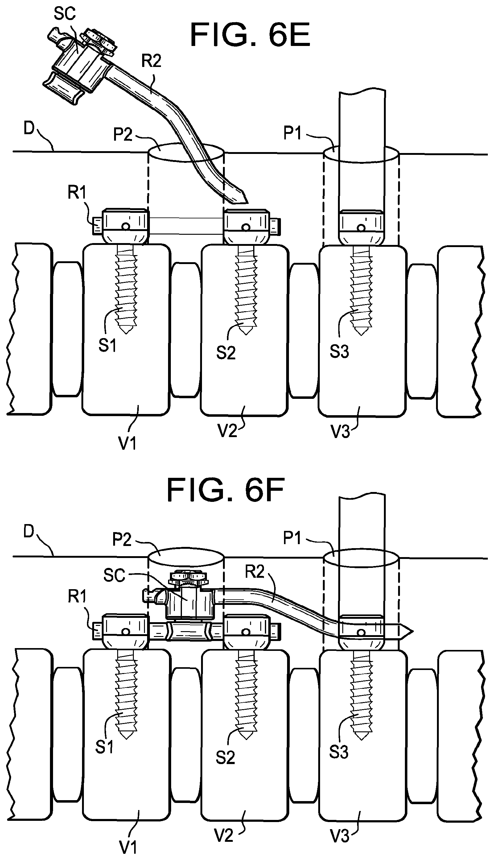 Patent US12508055 Figure 18 – Spinal connectors and related methods