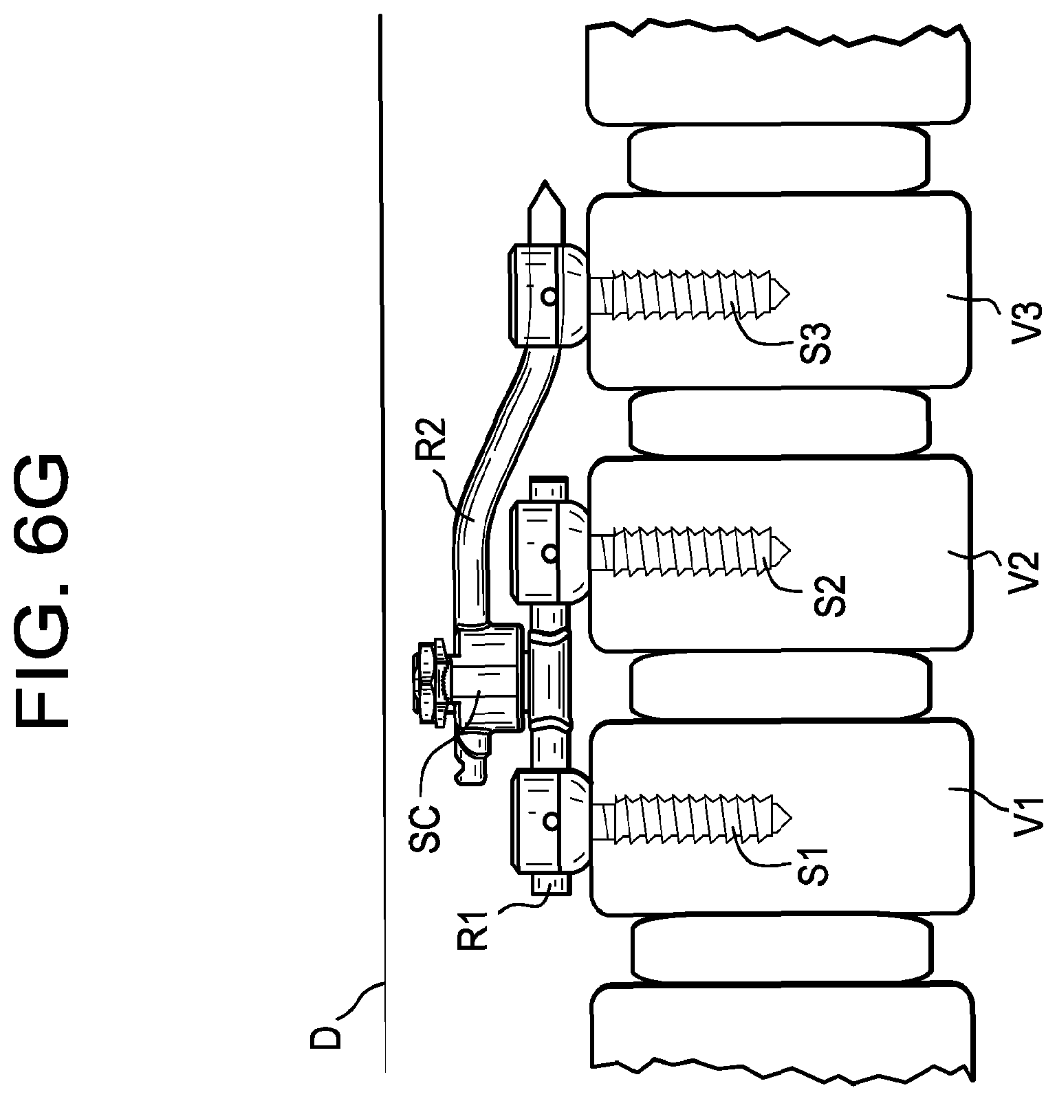Patent US12508055 Figure 19 – Spinal connectors and related methods