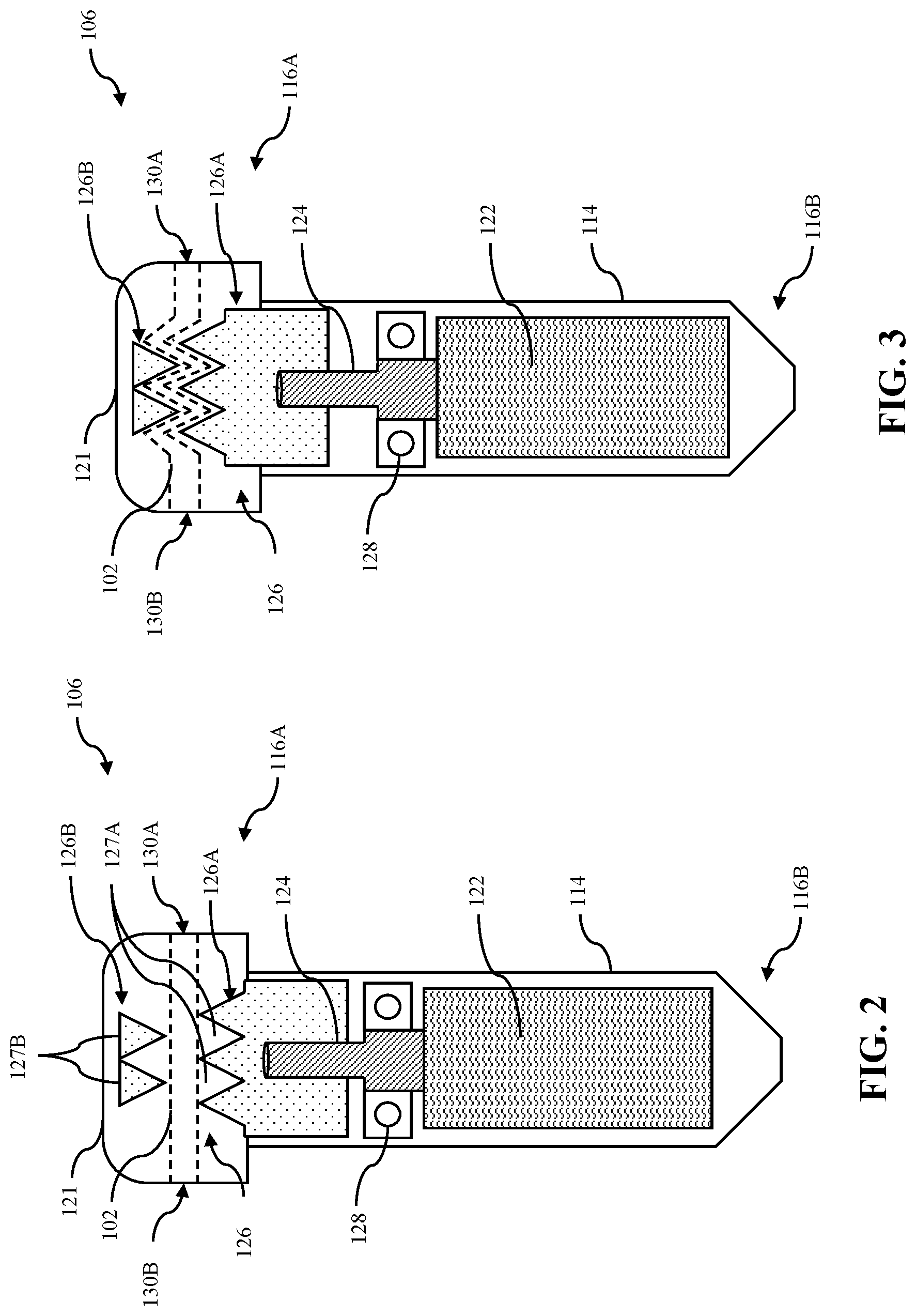 Patent US12508058 Figure 2 – Adjustable tether implant