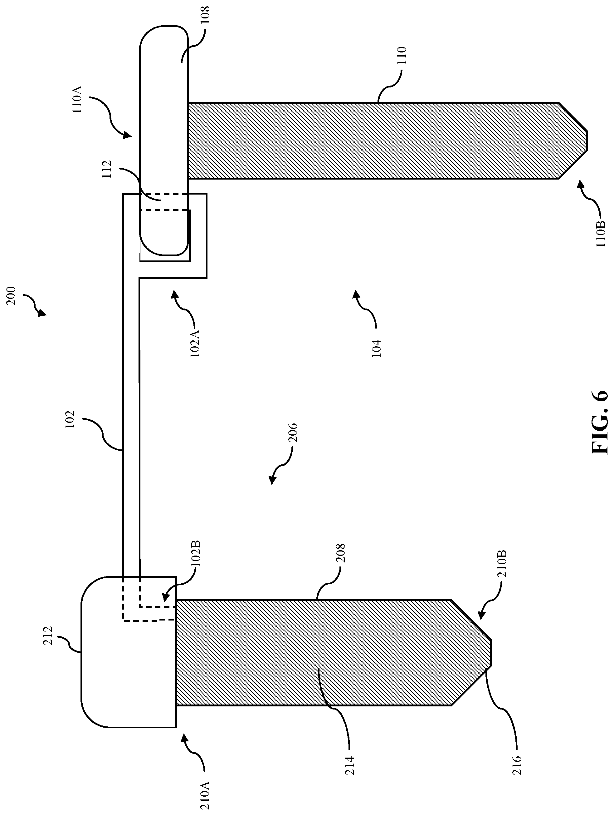 Patent US12508058 Figure 4 – Adjustable tether implant