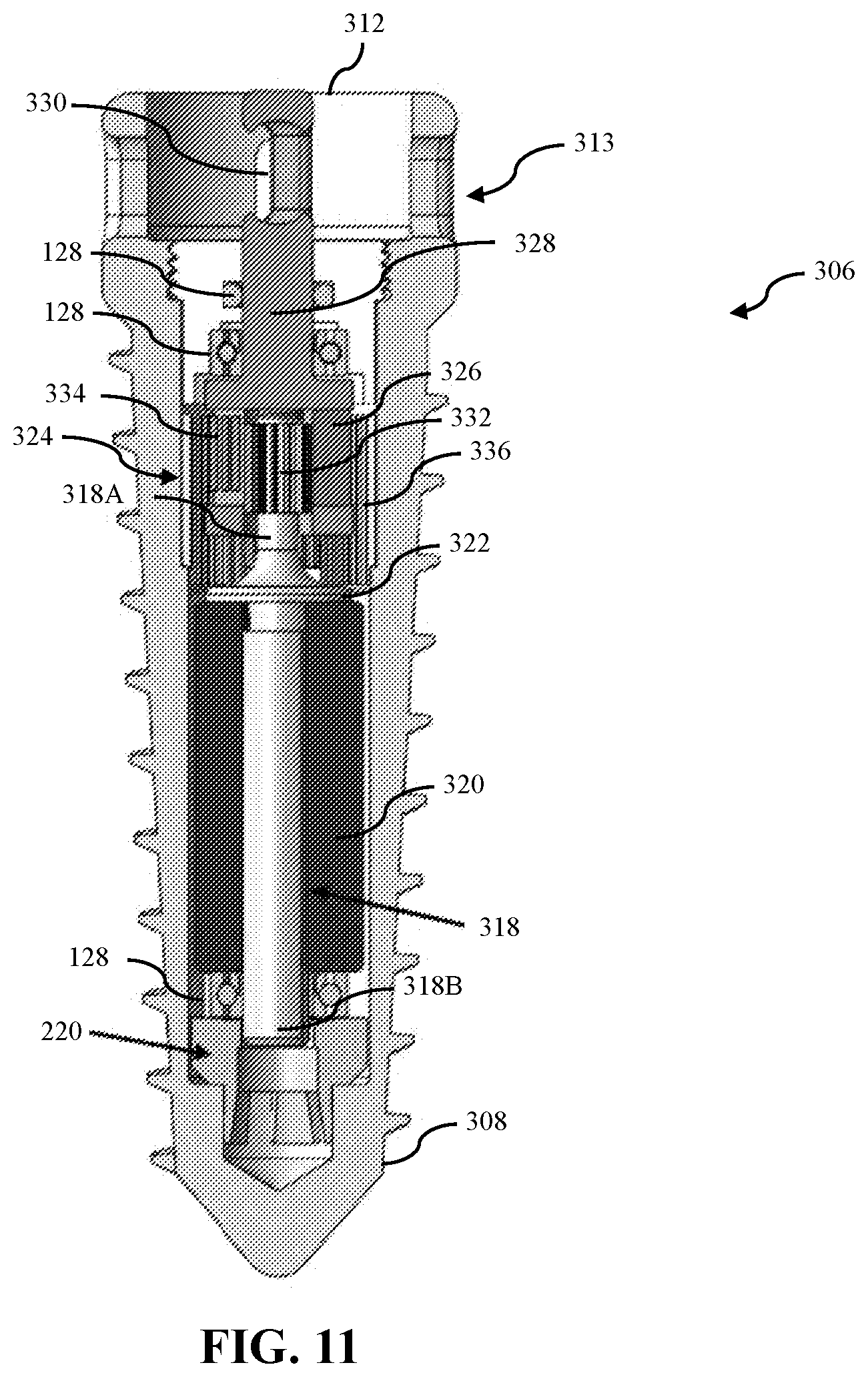 Patent US12508058 Figure 9 – Adjustable tether implant