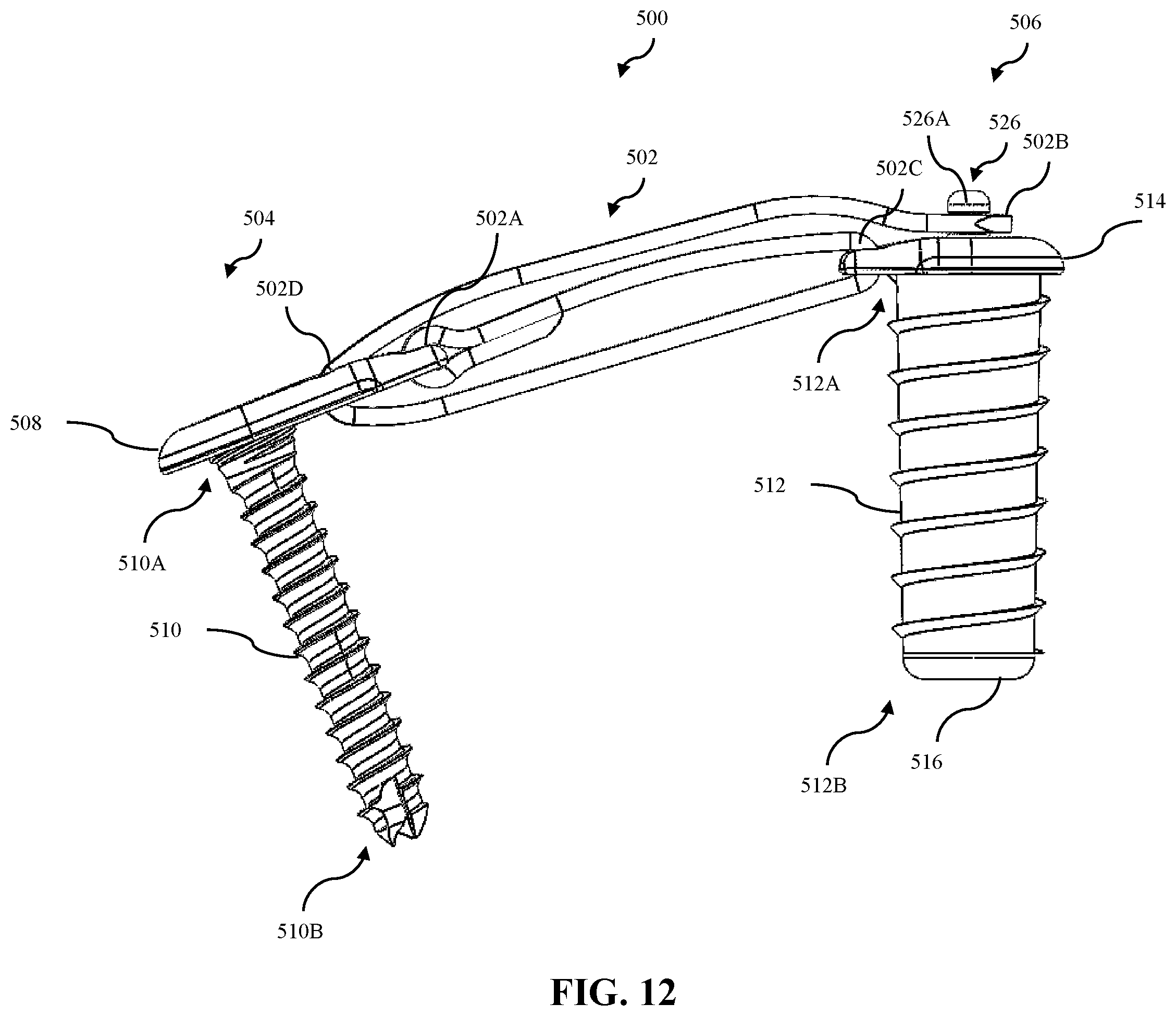 Patent US12508058 Figure 10 – Adjustable tether implant