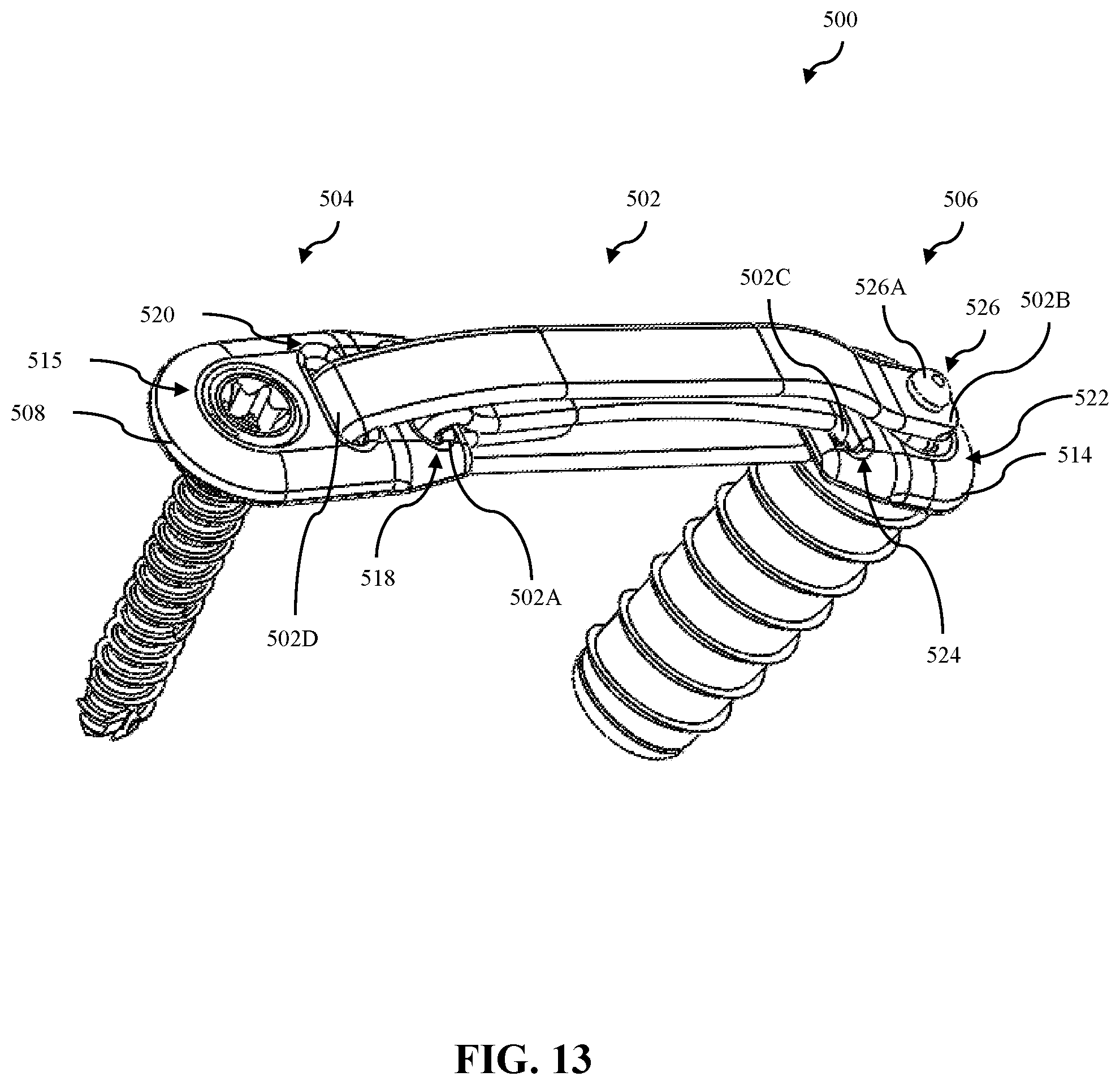 Patent US12508058 Figure 11 – Adjustable tether implant
