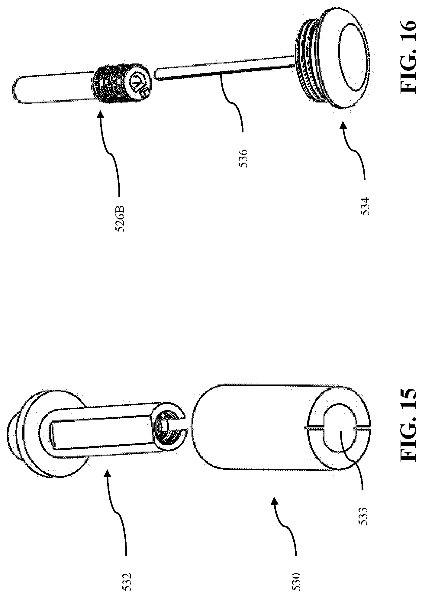 Patent US12508058 Figure 13 – Adjustable tether implant