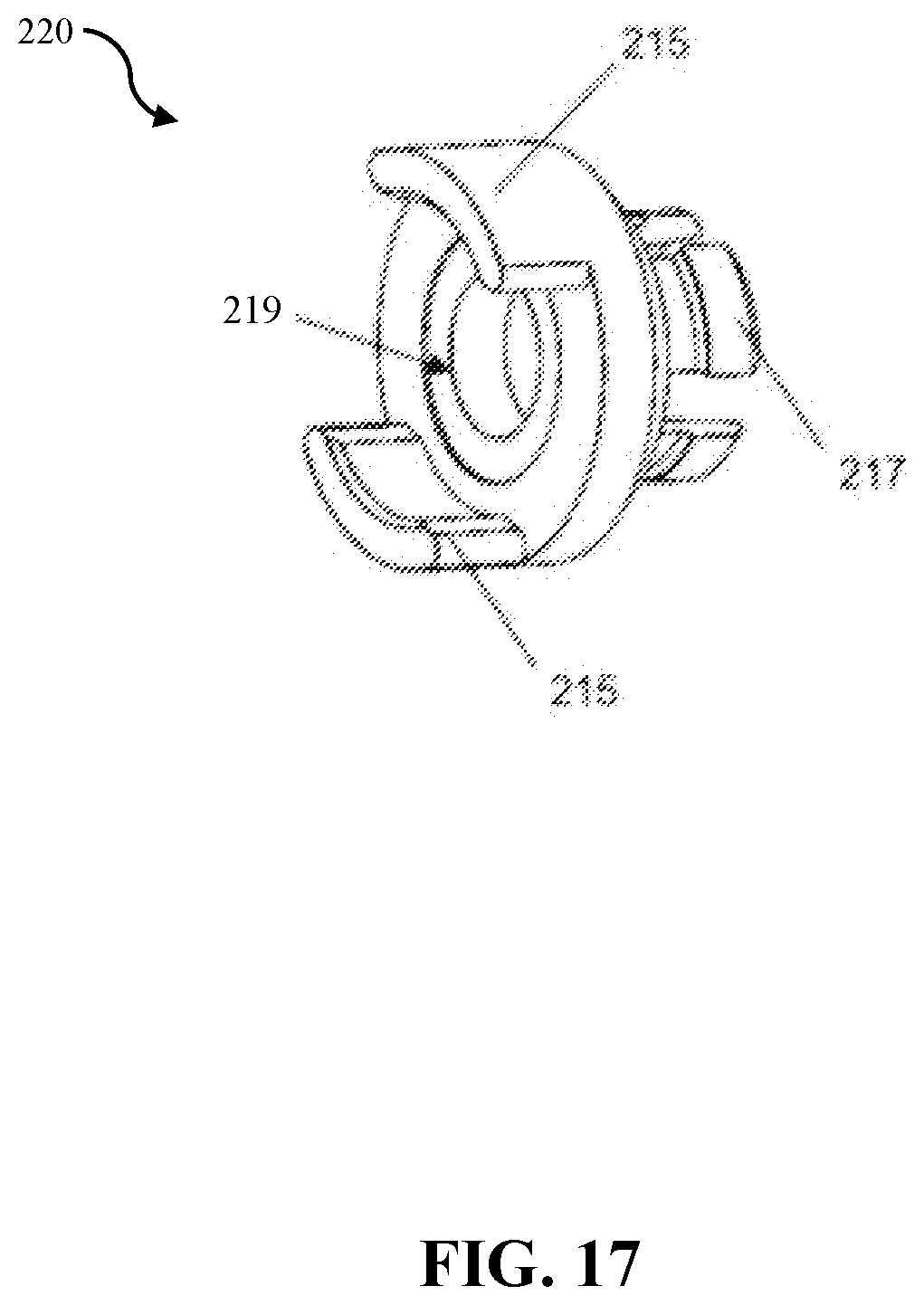 Patent US12508058 Figure 14 – Adjustable tether implant