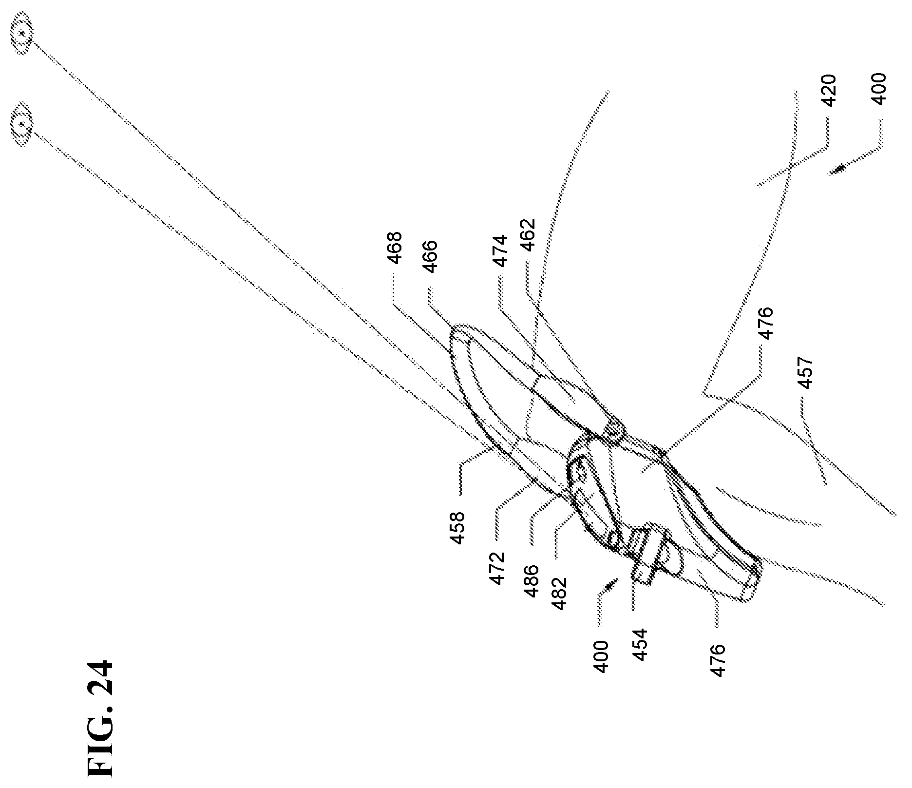 Patent US12508058 Figure 18 – Adjustable tether implant