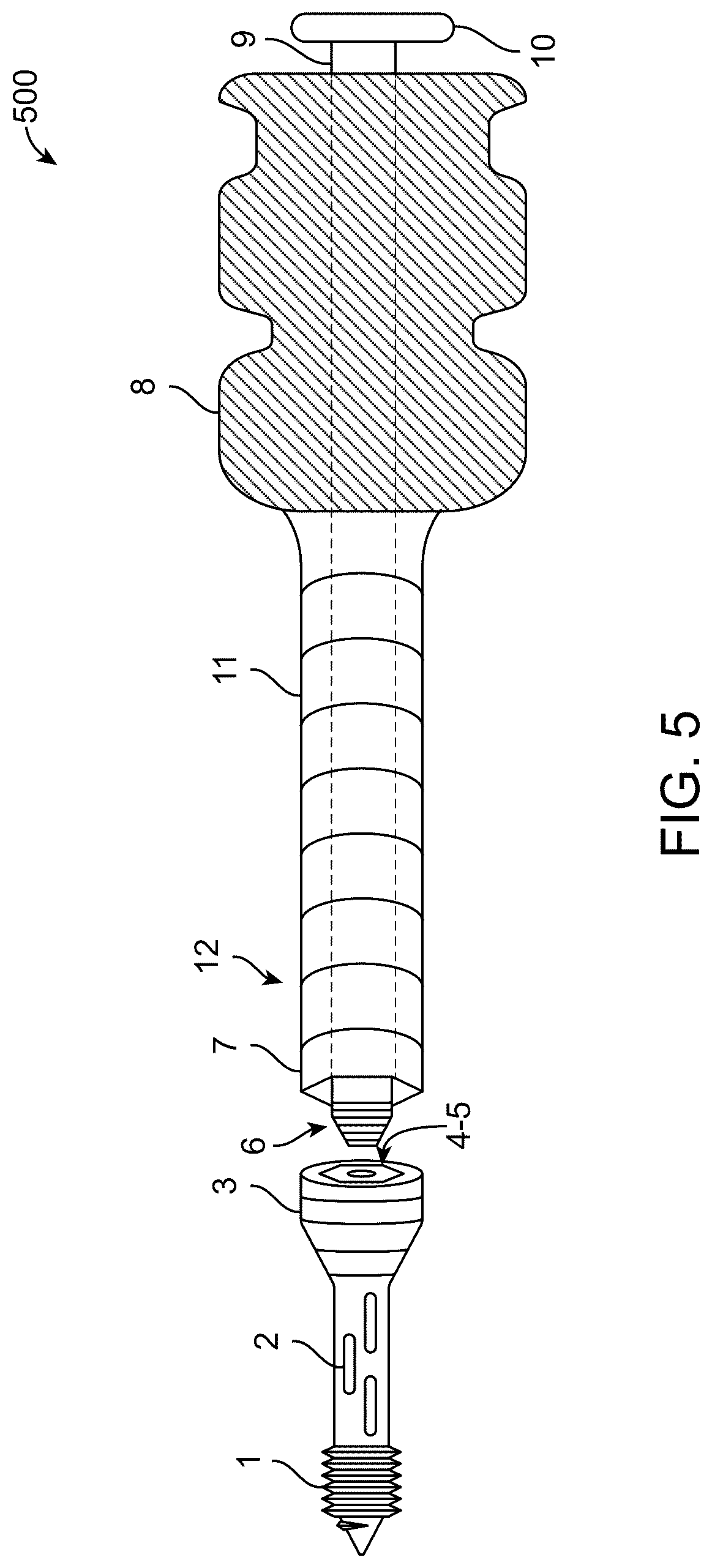 Patent US12508059 Figure 5 – Orthopedic screw and screw fastening device for orthopedic operations
