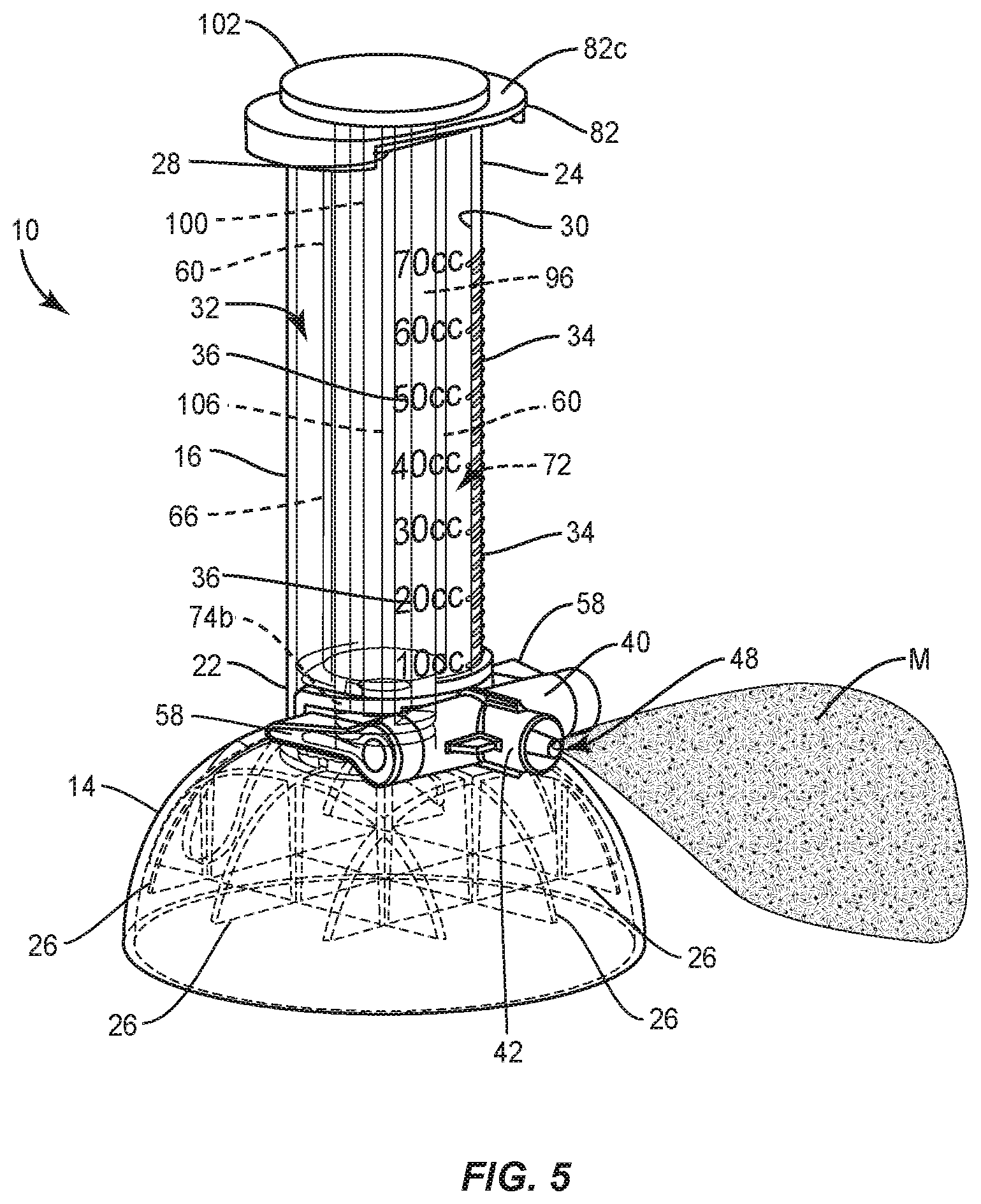 Patent US12508061 Figure 5 – Dispensing system and methods of use