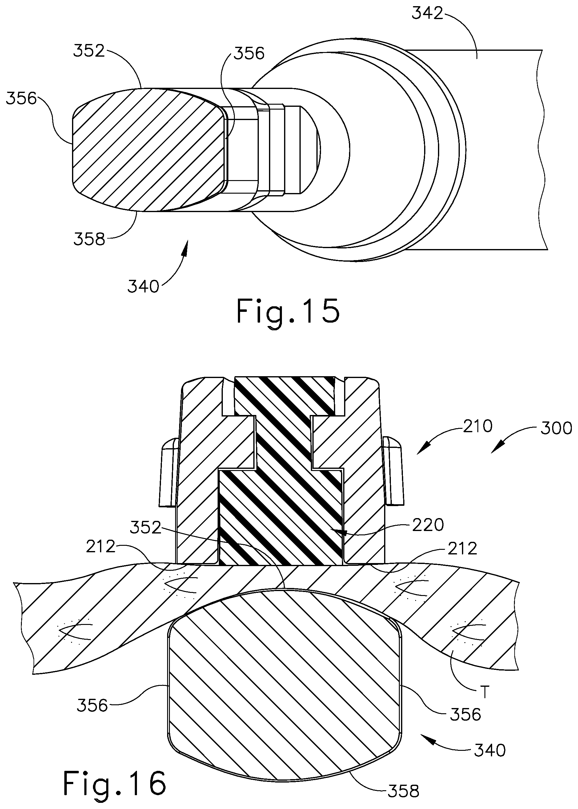 Patent US12508065 Figure 11 – Method of treating tissue using end effector with ultrasonic and electrosurgical features