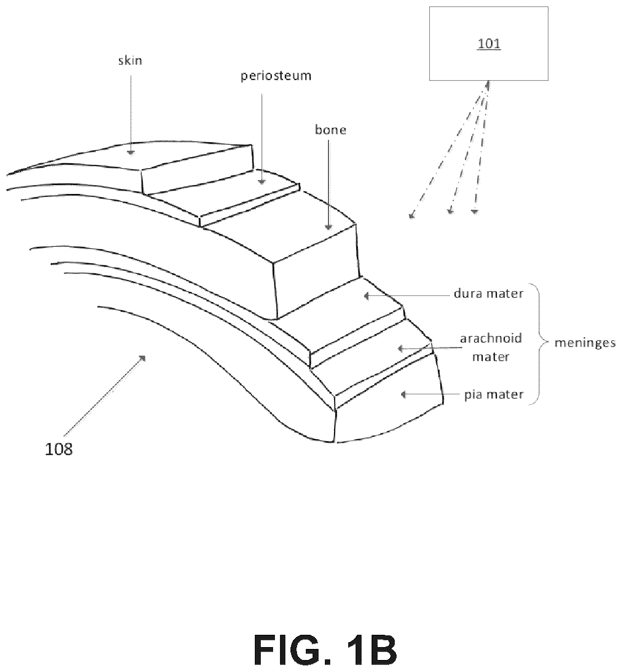 Patent US12508073 Figure 2 – Systems, devices, and methods for tissue layer removal