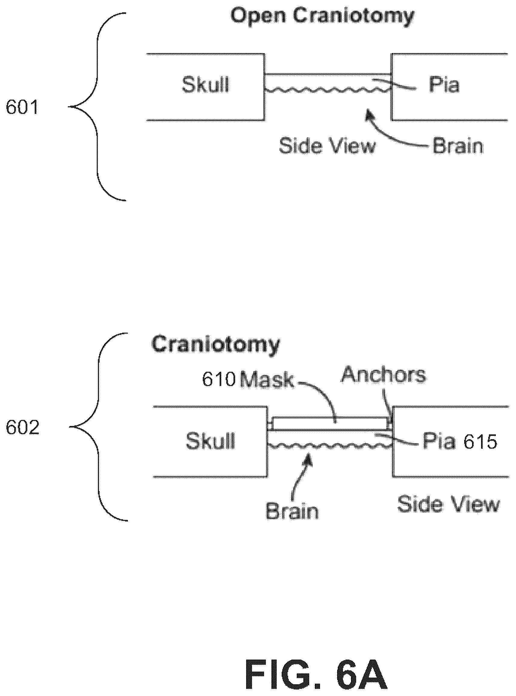 Patent US12508073 Figure 7 – Systems, devices, and methods for tissue layer removal