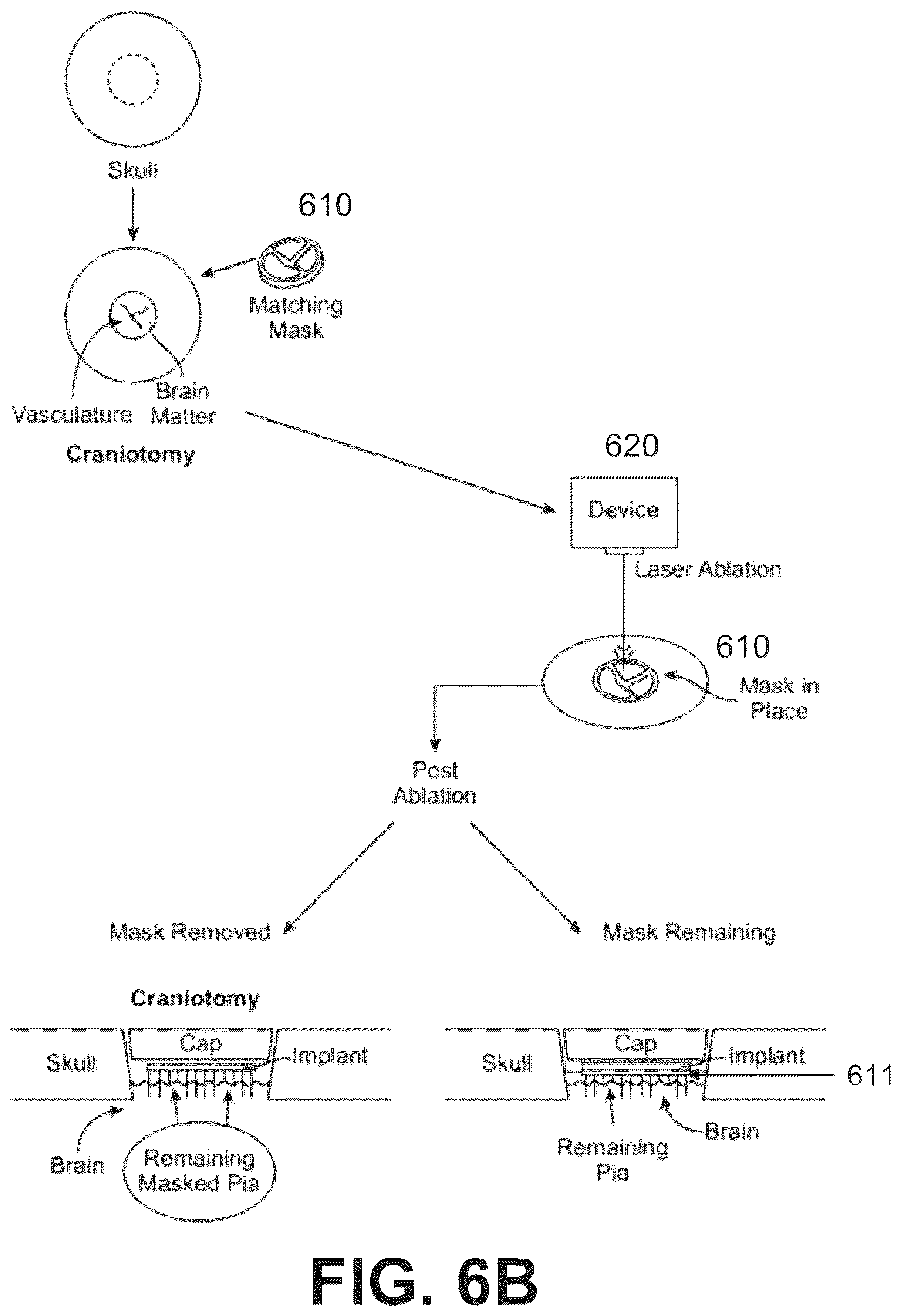 Patent US12508073 Figure 8 – Systems, devices, and methods for tissue layer removal