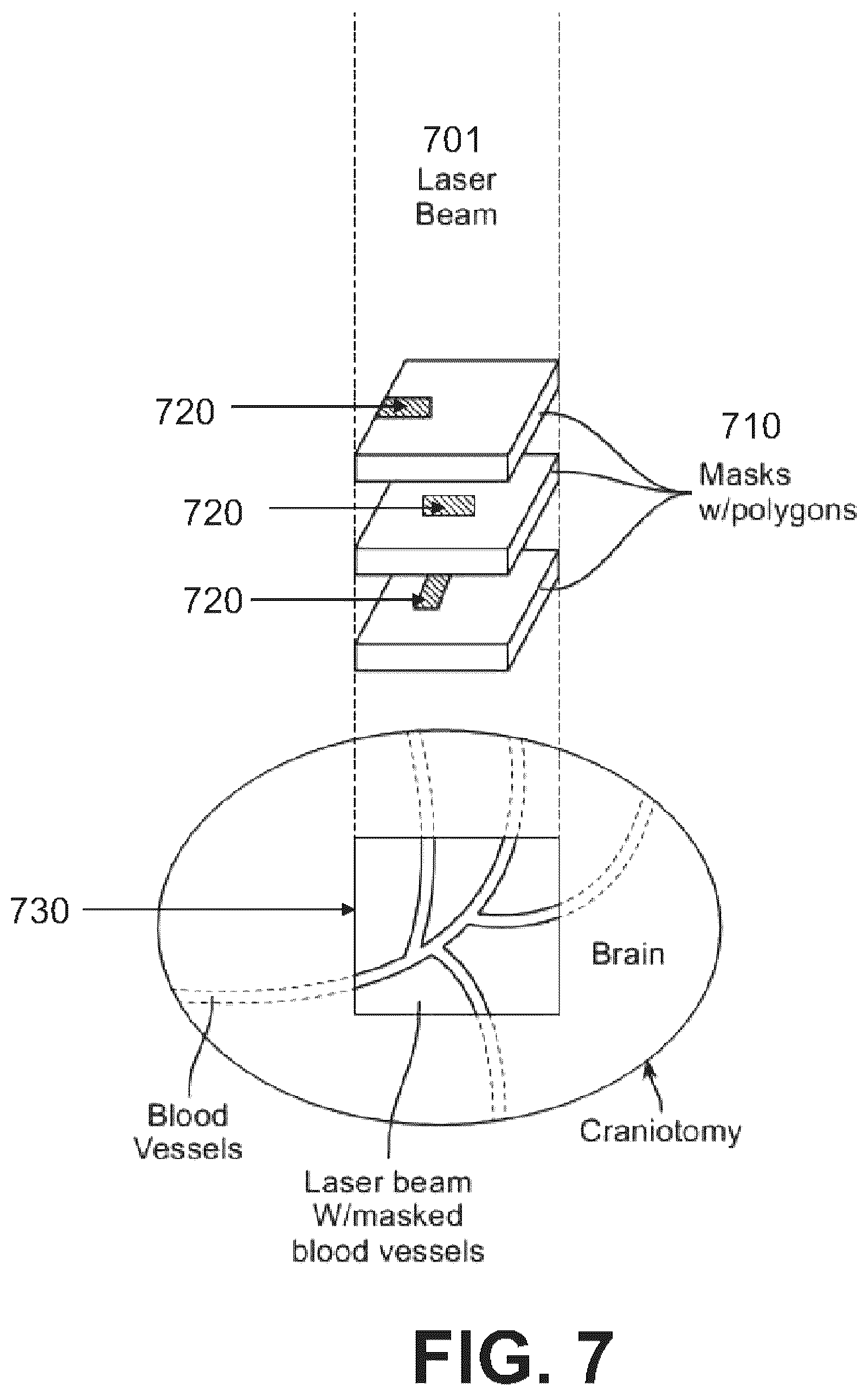 Patent US12508073 Figure 9 – Systems, devices, and methods for tissue layer removal