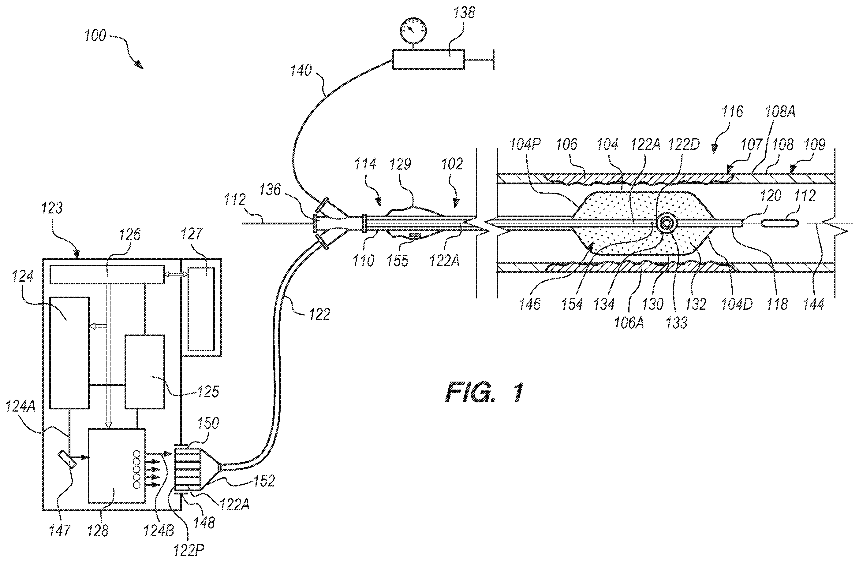 Patent US12508076 — Multiplexer for laser-driven intravascular lithotripsy device — Figure 1