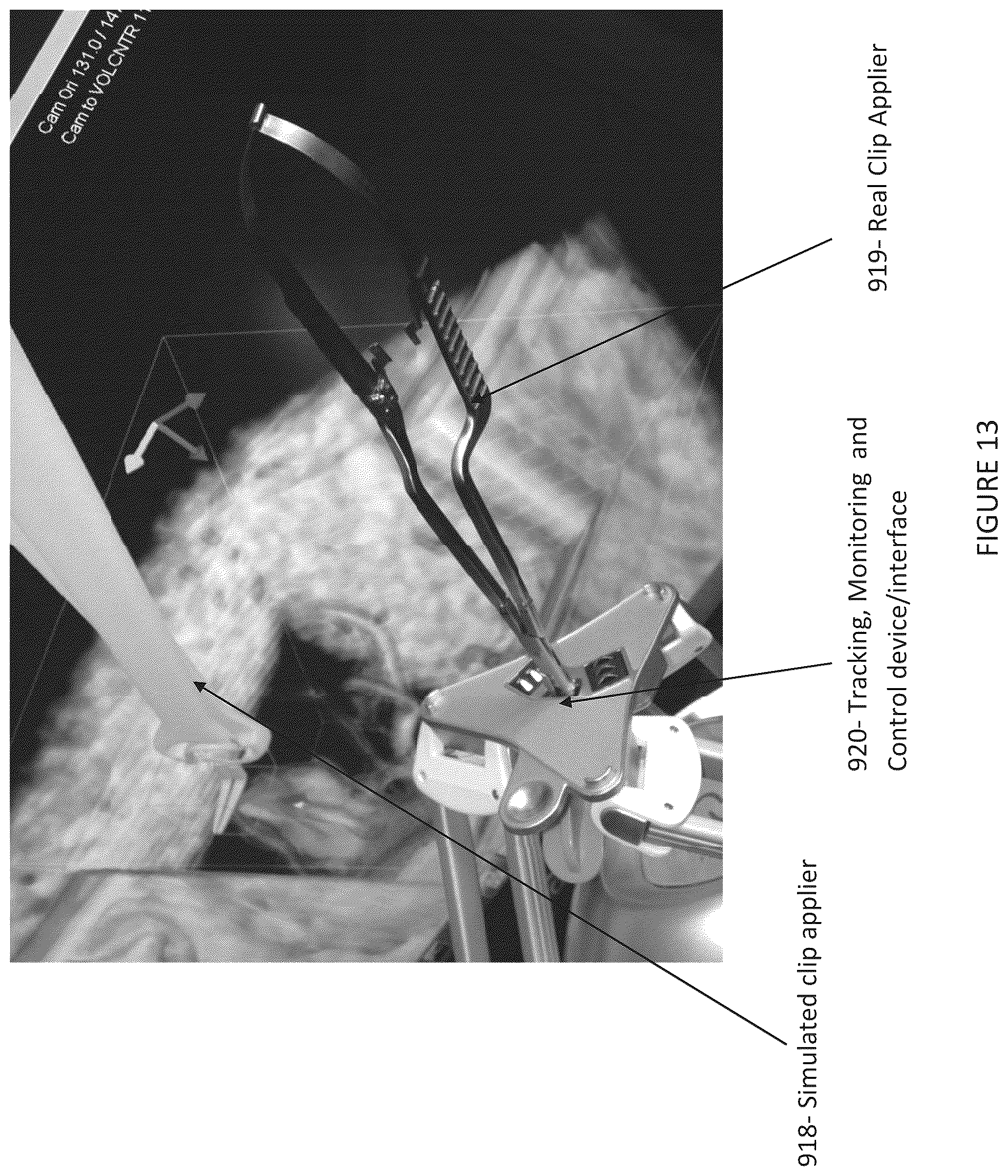 Patent US12508077 Figure 17 – Method and system for simulating surgical procedures