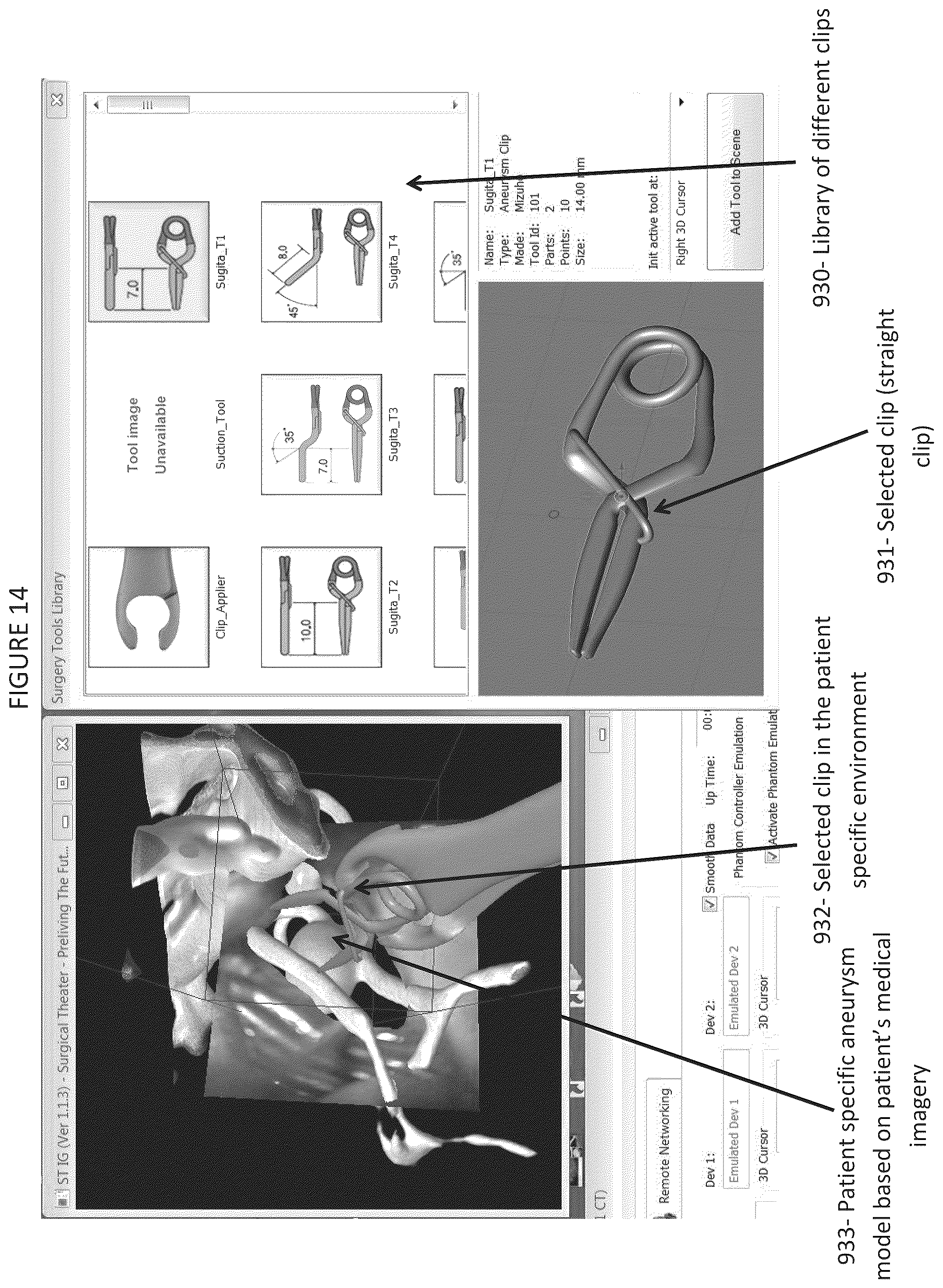 Patent US12508077 Figure 18 – Method and system for simulating surgical procedures