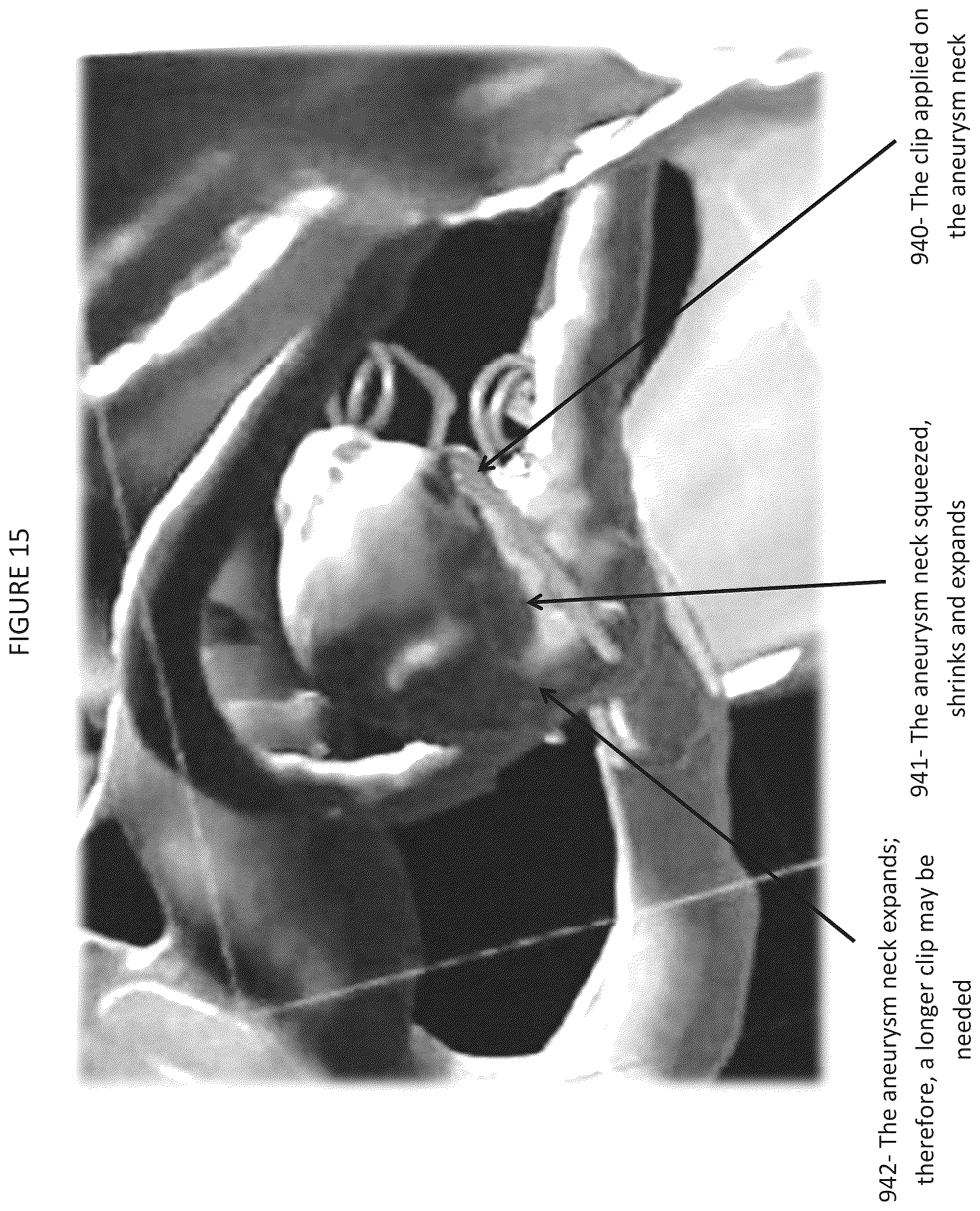Patent US12508077 Figure 19 – Method and system for simulating surgical procedures