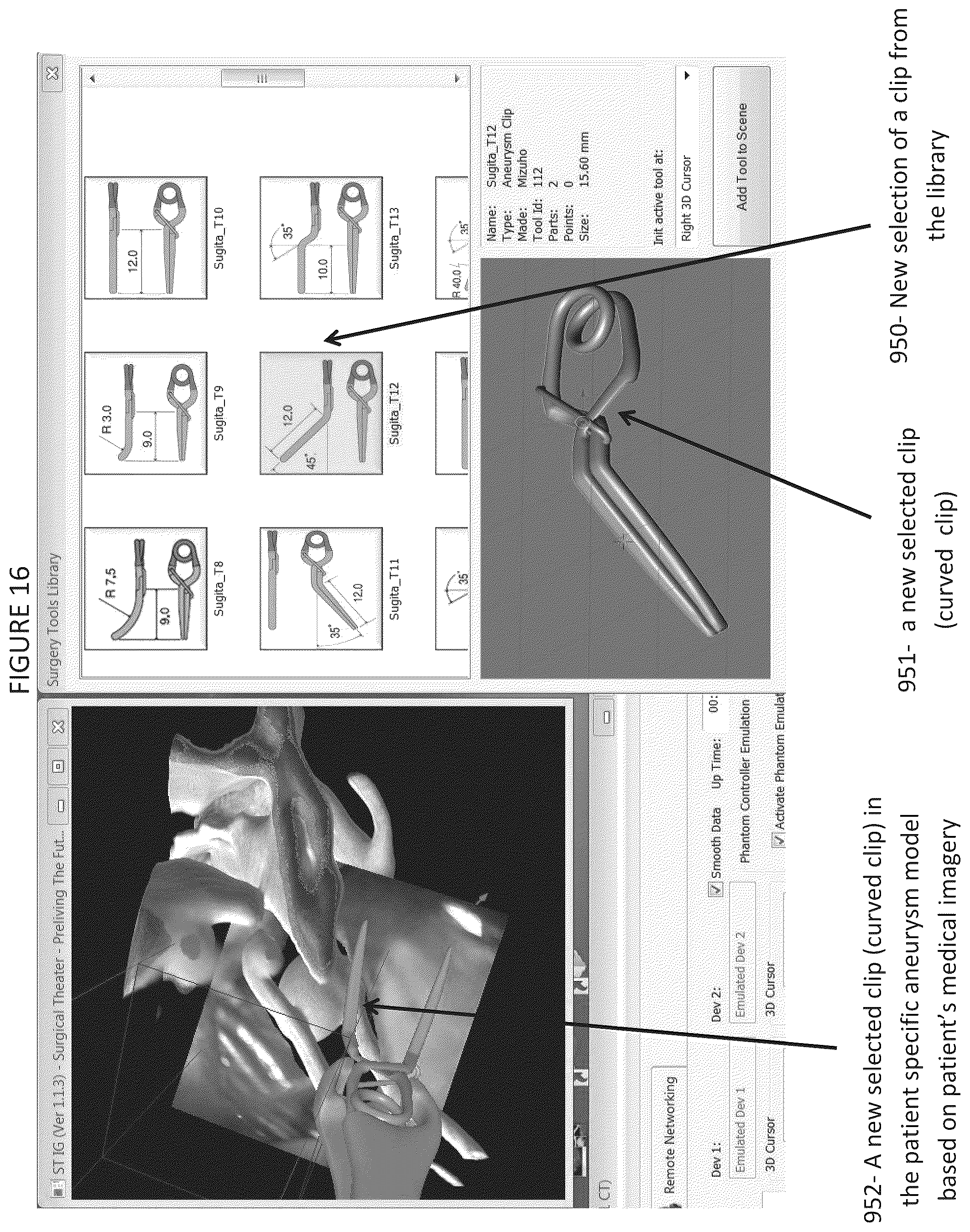 Patent US12508077 Figure 20 – Method and system for simulating surgical procedures