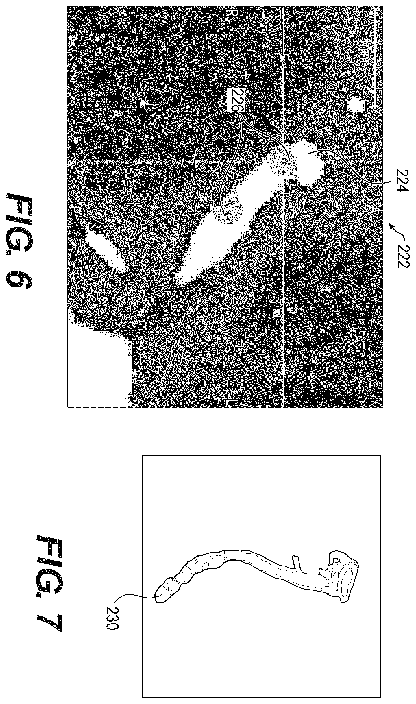 Patent US12508078 Figure 5 – Systems and method for performing particle-based simulation of fluid flow