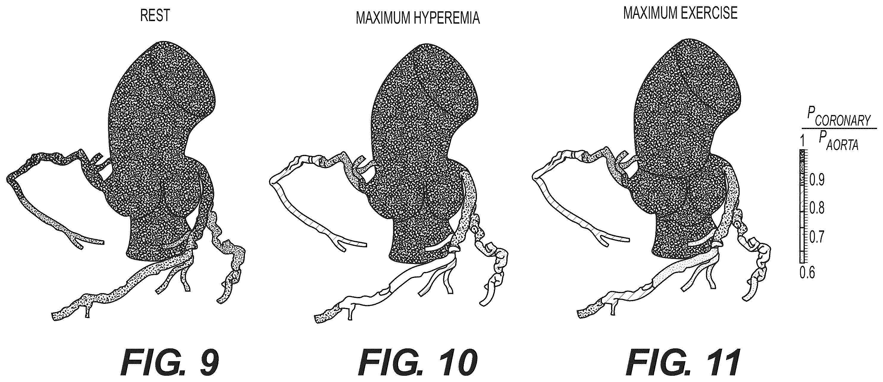 Patent US12508078 Figure 7 – Systems and method for performing particle-based simulation of fluid flow