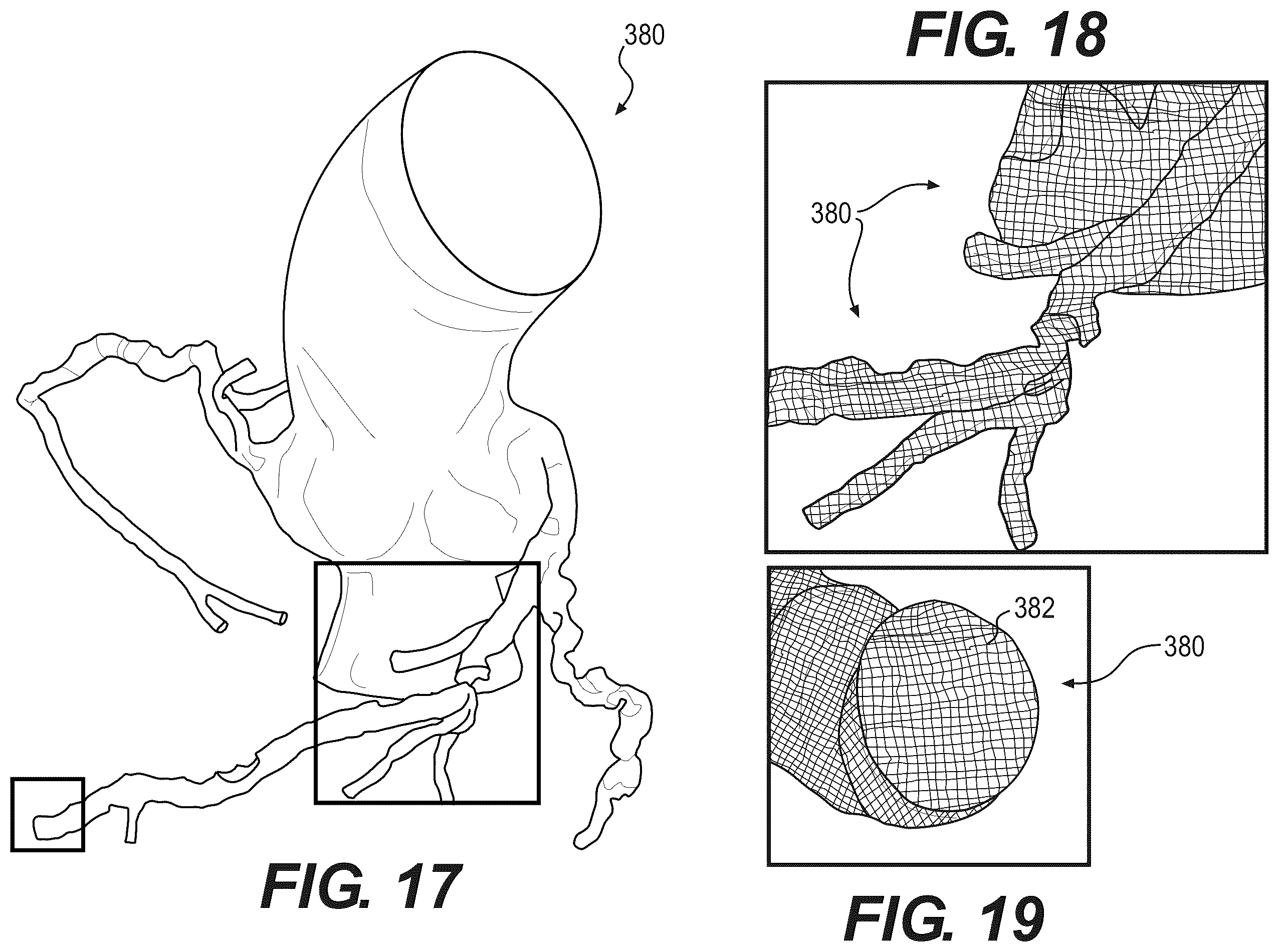 Patent US12508078 Figure 10 – Systems and method for performing particle-based simulation of fluid flow