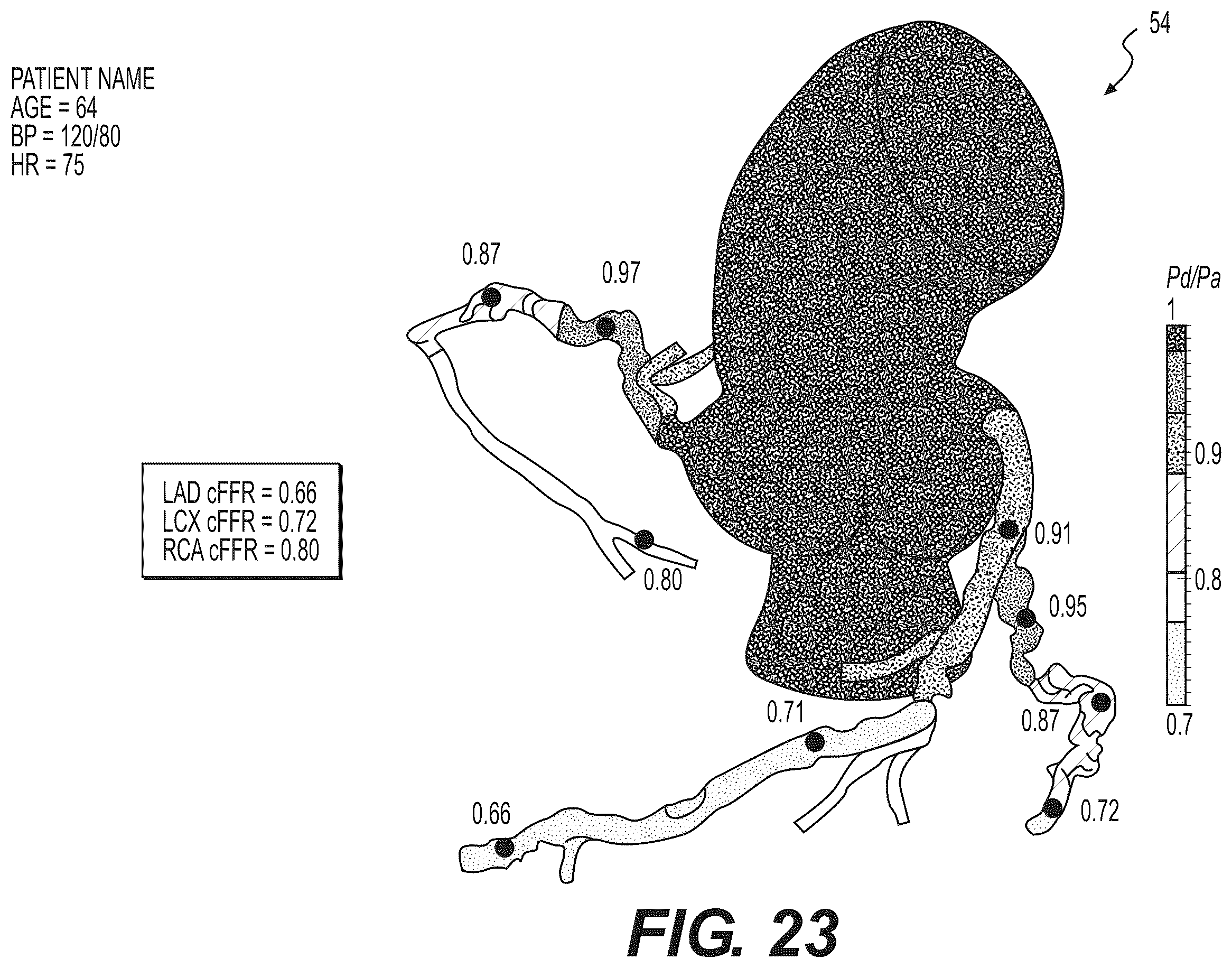 Patent US12508078 Figure 12 – Systems and method for performing particle-based simulation of fluid flow