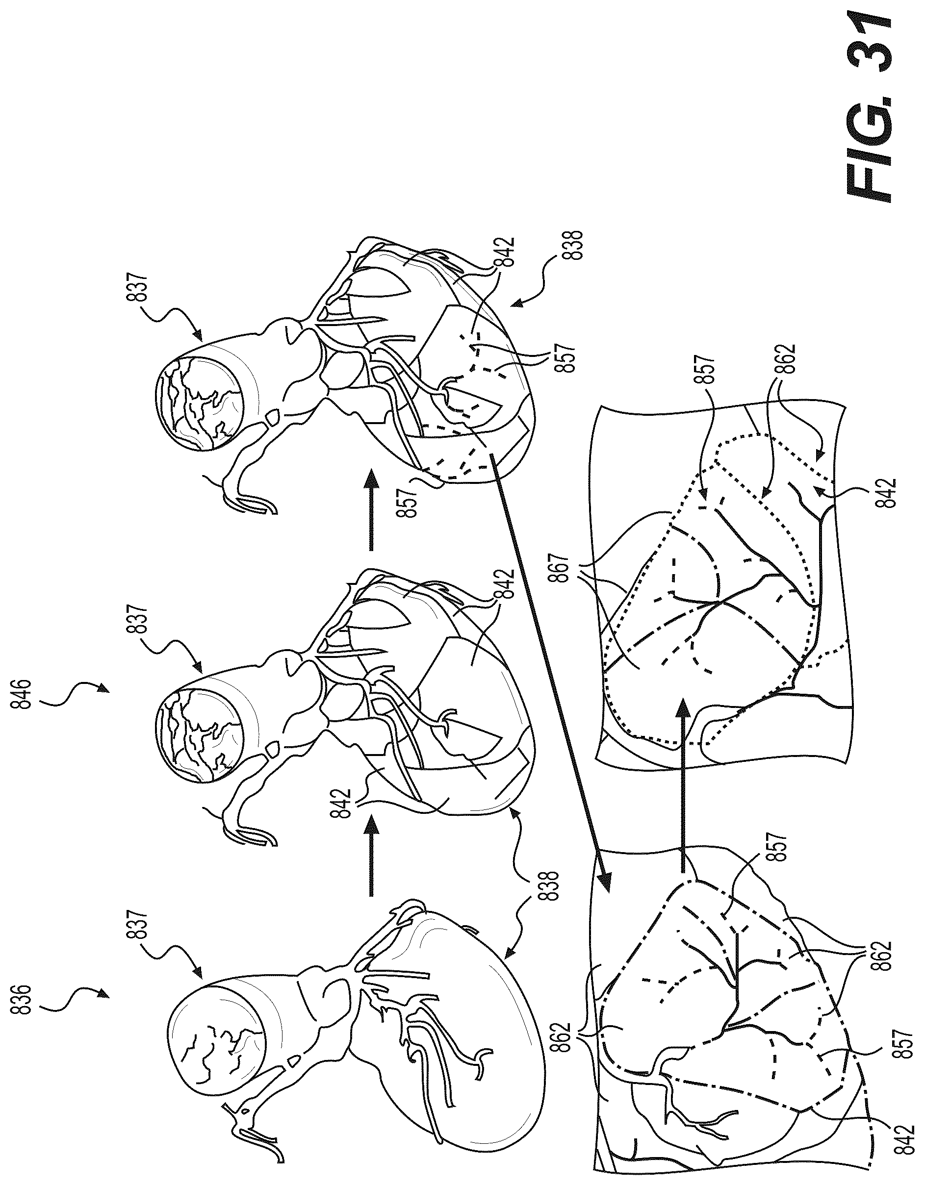 Patent US12508078 Figure 20 – Systems and method for performing particle-based simulation of fluid flow