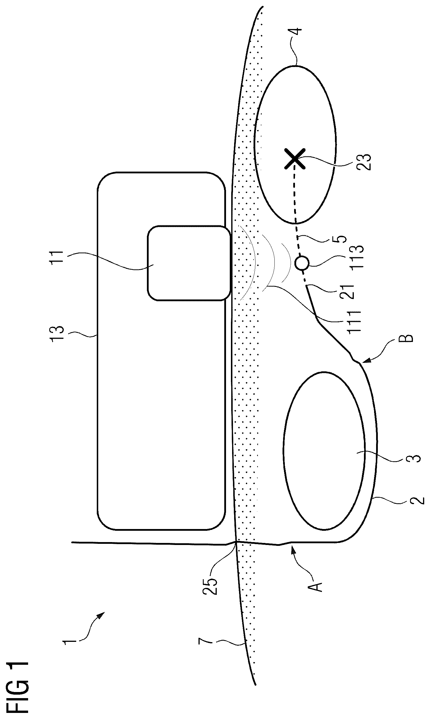 Patent US12508080 Figure 1 – Path preparation system for preparing a path for a device
