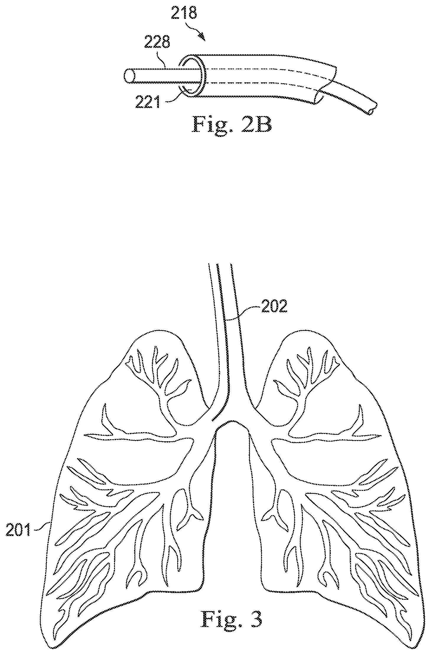 Patent US12508081 Figure 3 – Systems and methods of pose estimation and calibration of perspective imaging system in image guided surgery