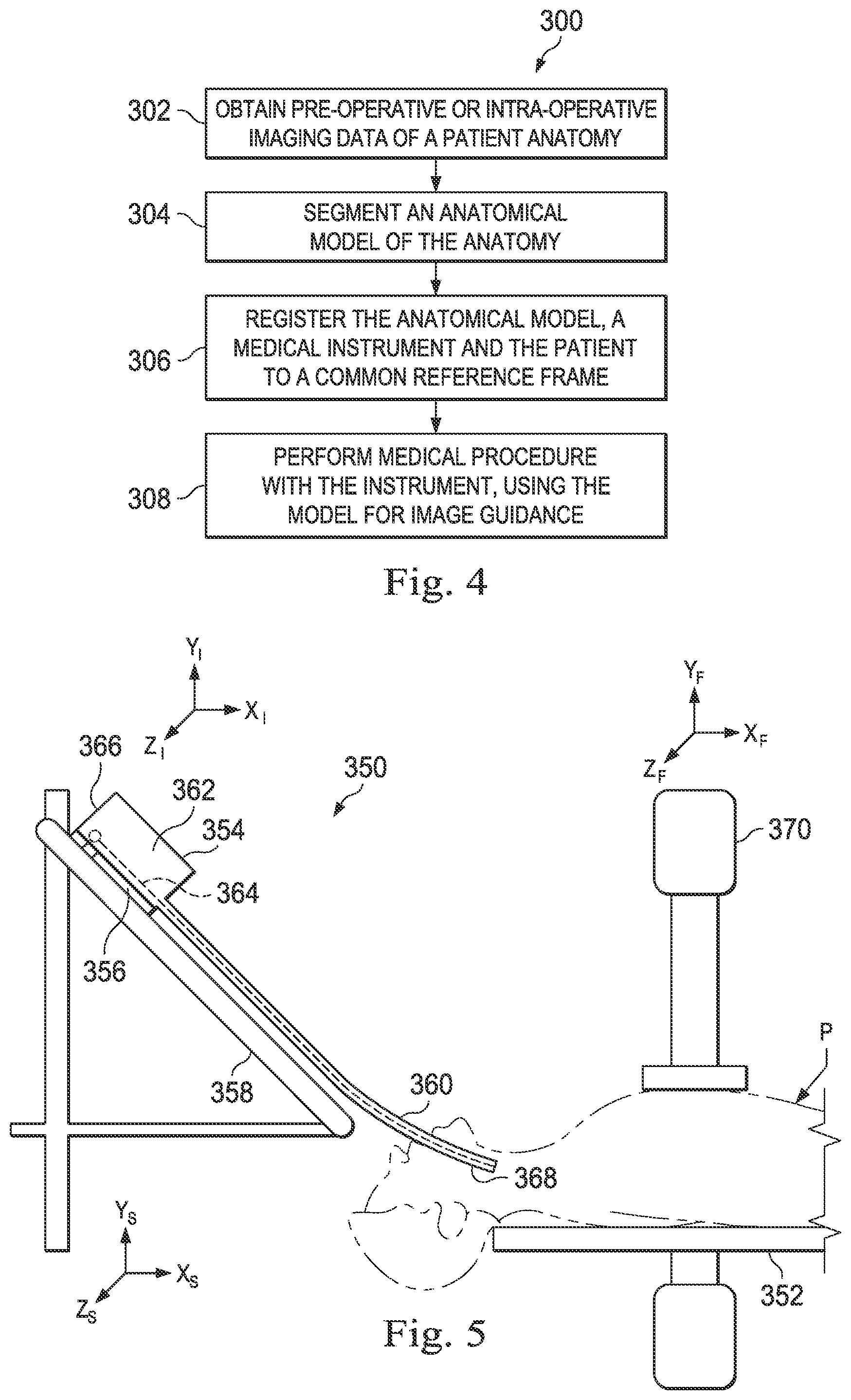Patent US12508081 Figure 4 – Systems and methods of pose estimation and calibration of perspective imaging system in image guided surgery