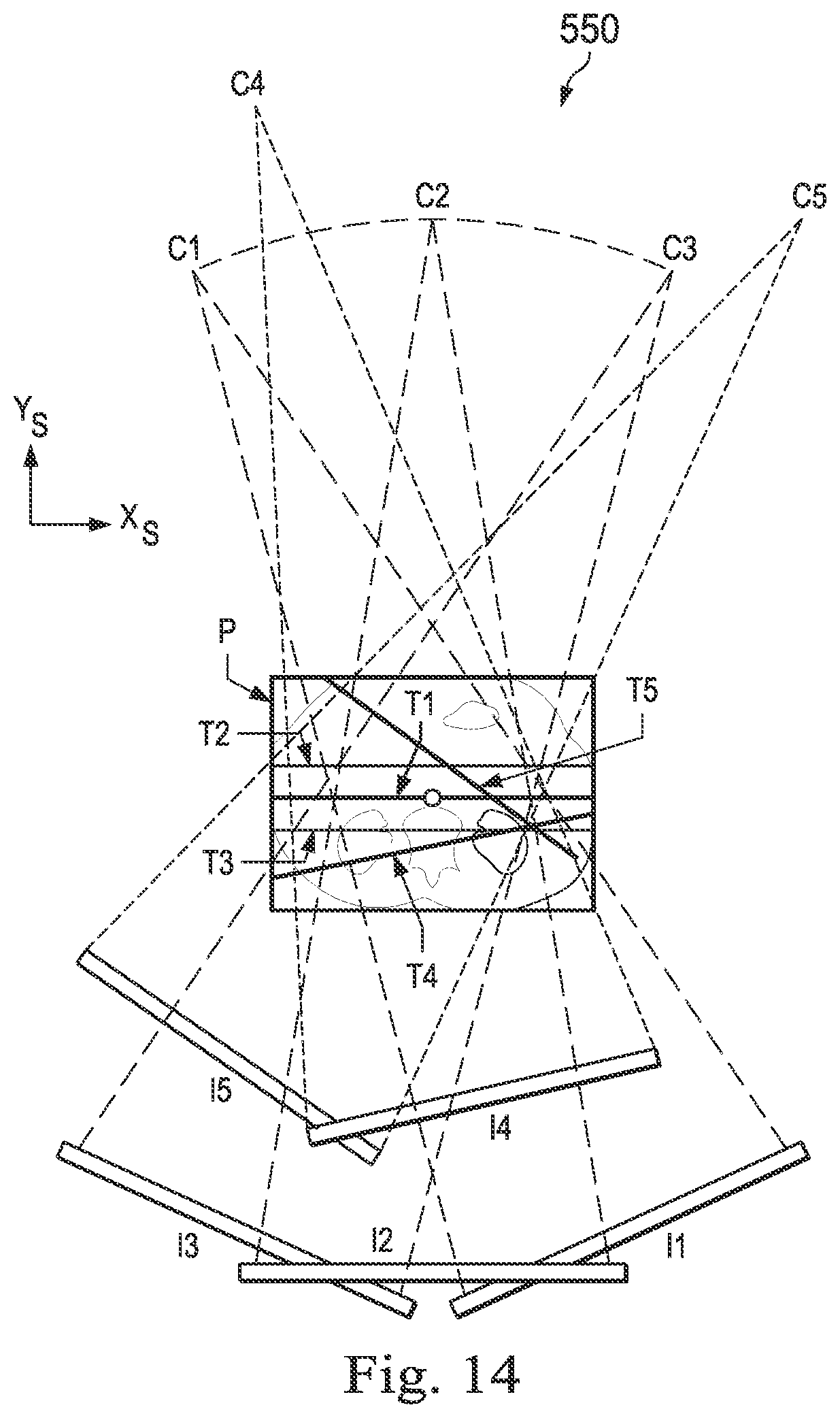 Patent US12508081 Figure 12 – Systems and methods of pose estimation and calibration of perspective imaging system in image guided surgery