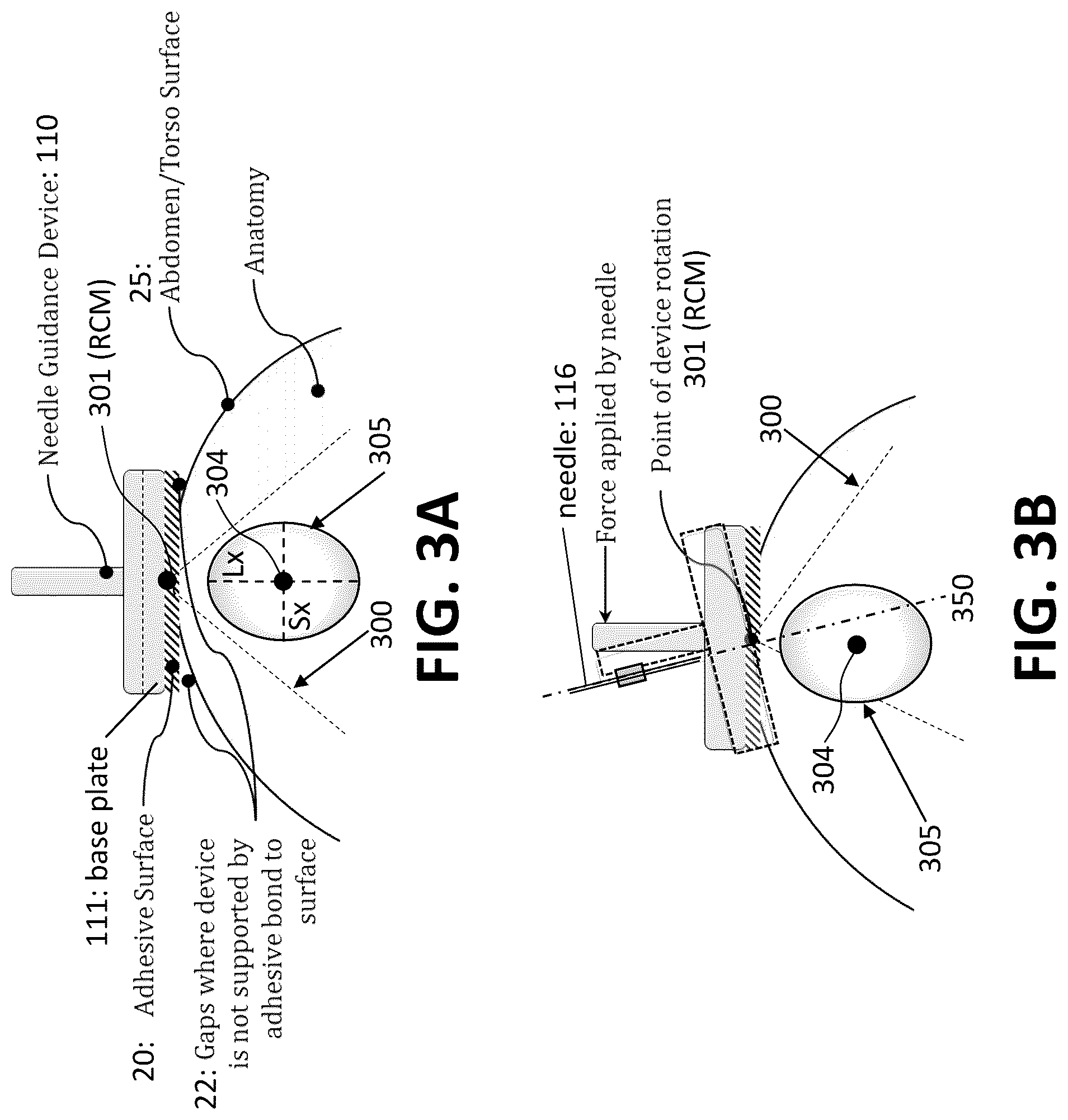 Patent US12508082 Figure 3 – Parametric contour map visualization for needle guide system