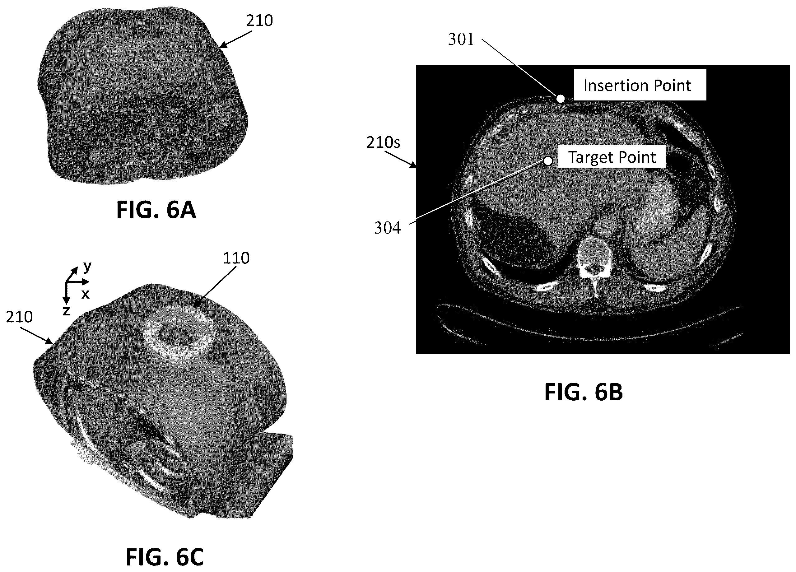 Patent US12508082 Figure 6 – Parametric contour map visualization for needle guide system