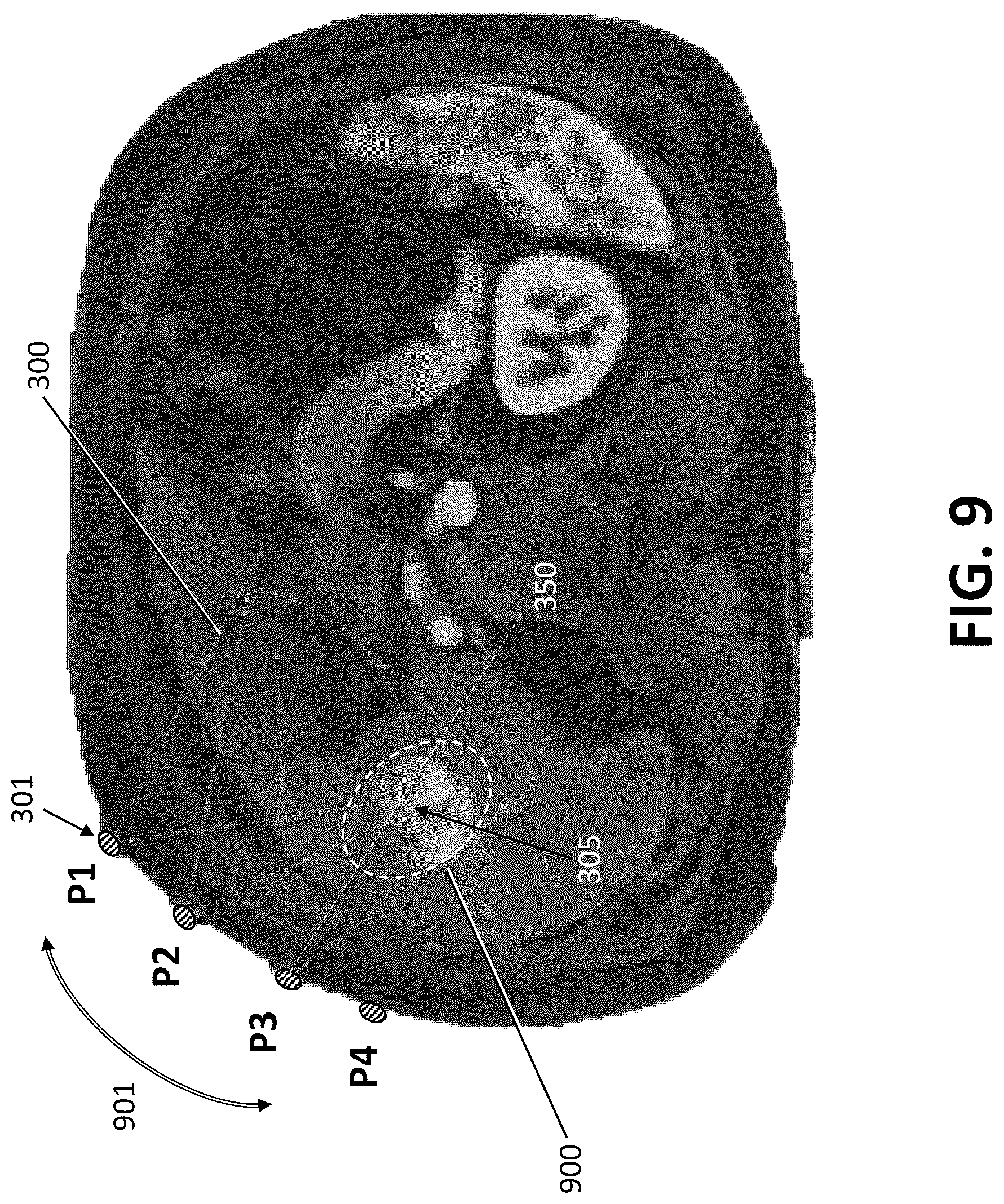 Patent US12508082 Figure 9 – Parametric contour map visualization for needle guide system