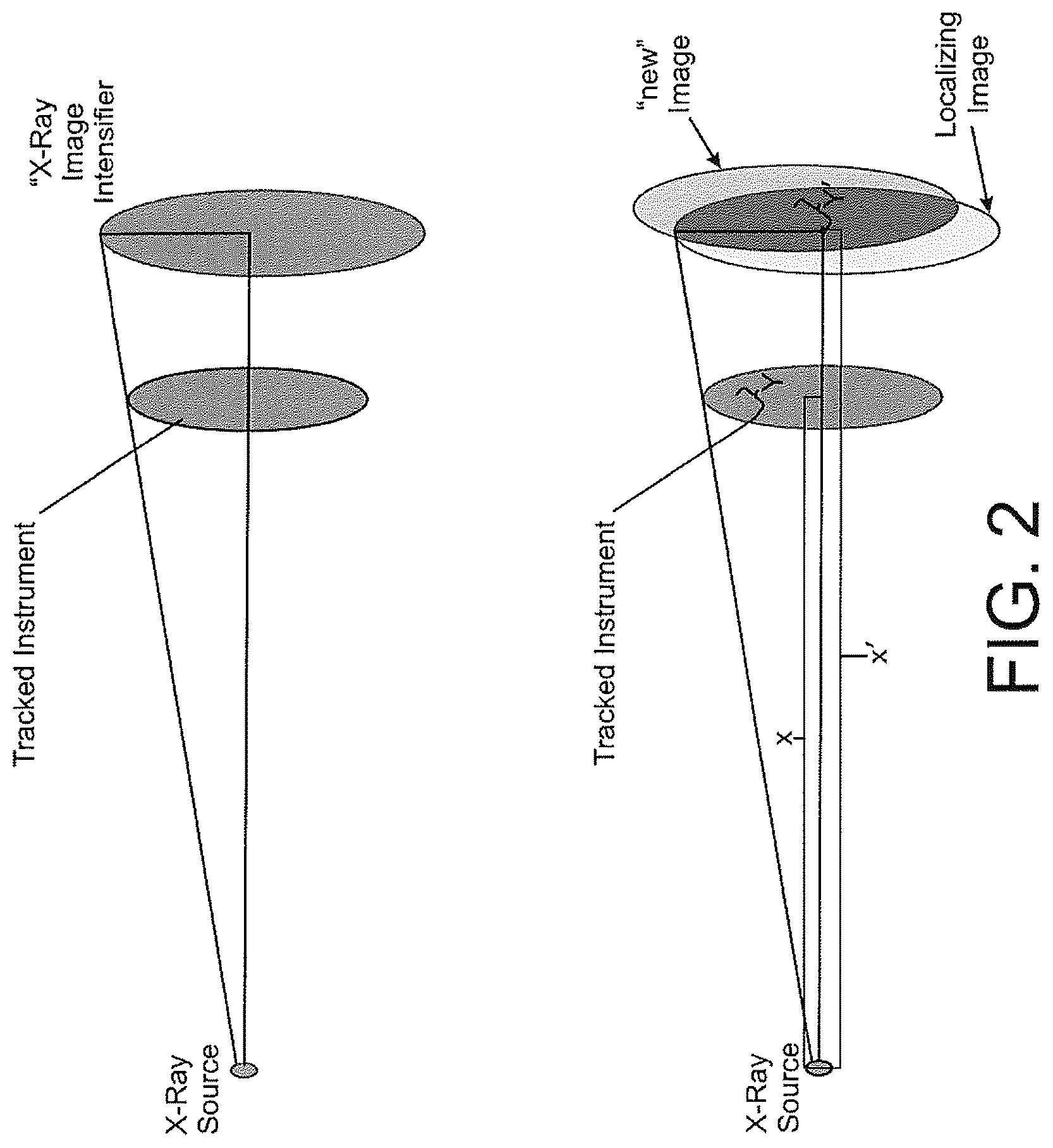 Patent US12508083 Figure 2 – System and method for image localization of effecters during a medical procedure