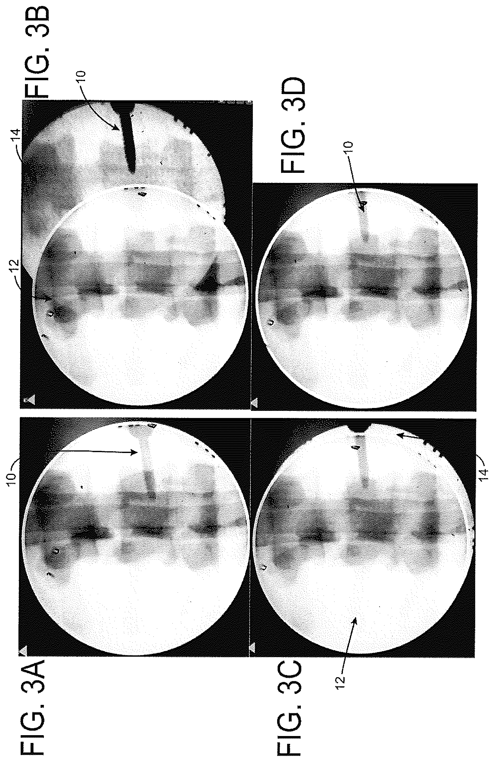 Patent US12508083 Figure 3 – System and method for image localization of effecters during a medical procedure