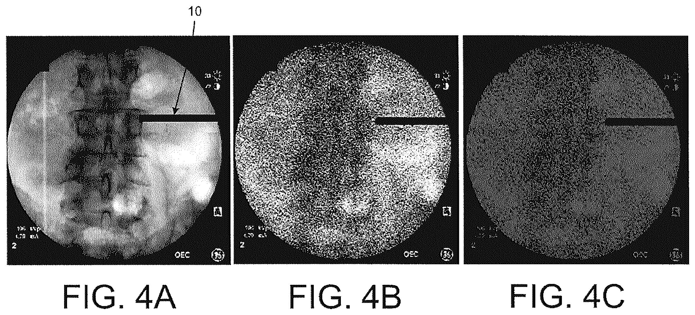 Patent US12508083 Figure 4 – System and method for image localization of effecters during a medical procedure