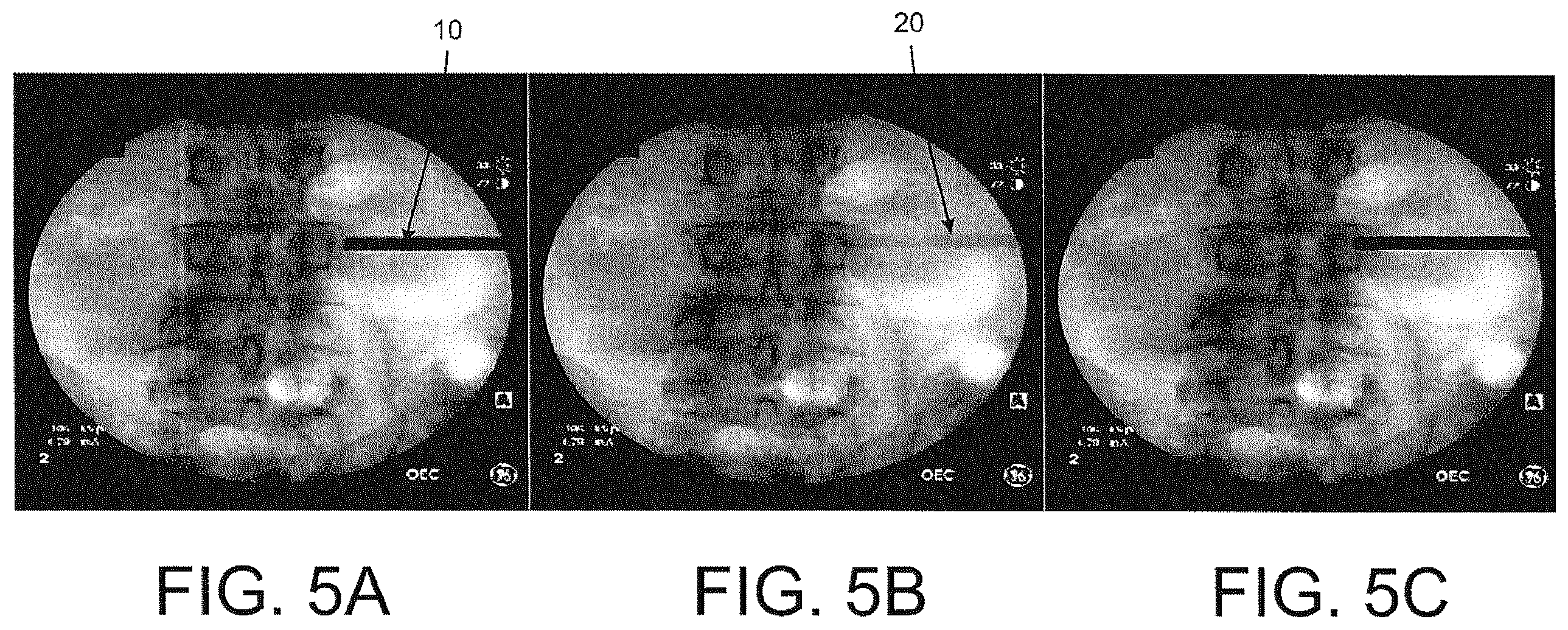 Patent US12508083 Figure 5 – System and method for image localization of effecters during a medical procedure