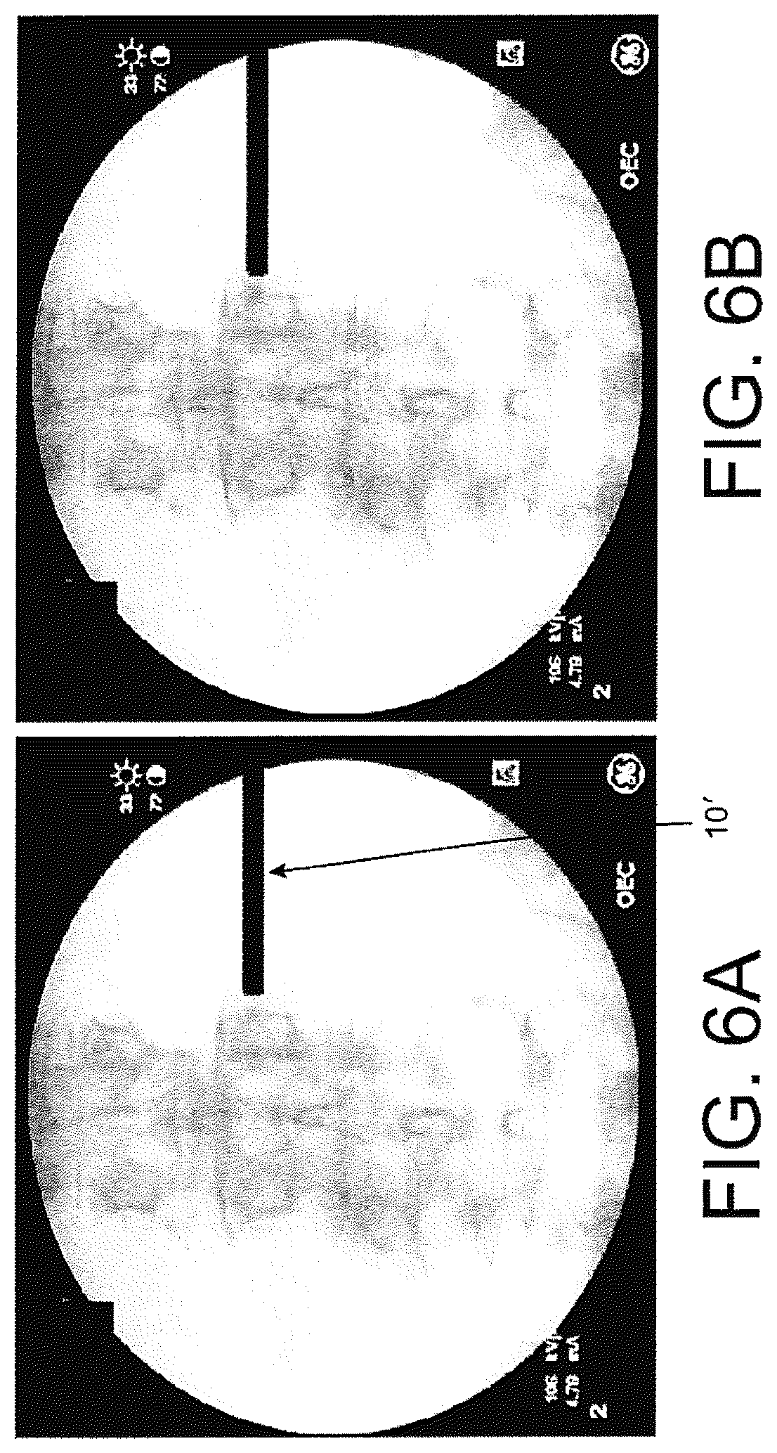 Patent US12508083 Figure 6 – System and method for image localization of effecters during a medical procedure