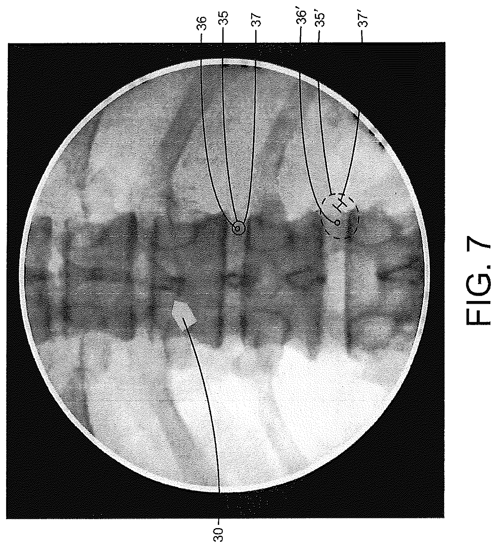 Patent US12508083 Figure 7 – System and method for image localization of effecters during a medical procedure