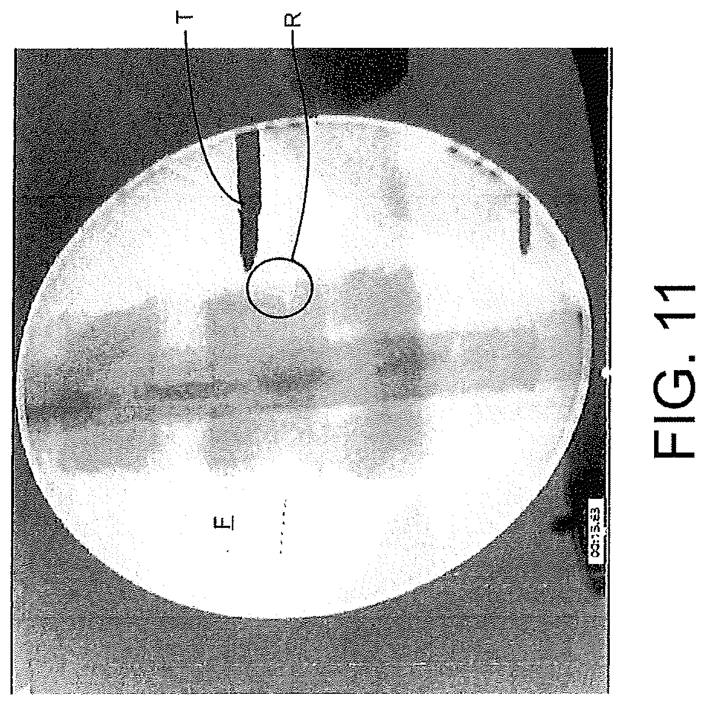 Patent US12508083 Figure 10 – System and method for image localization of effecters during a medical procedure
