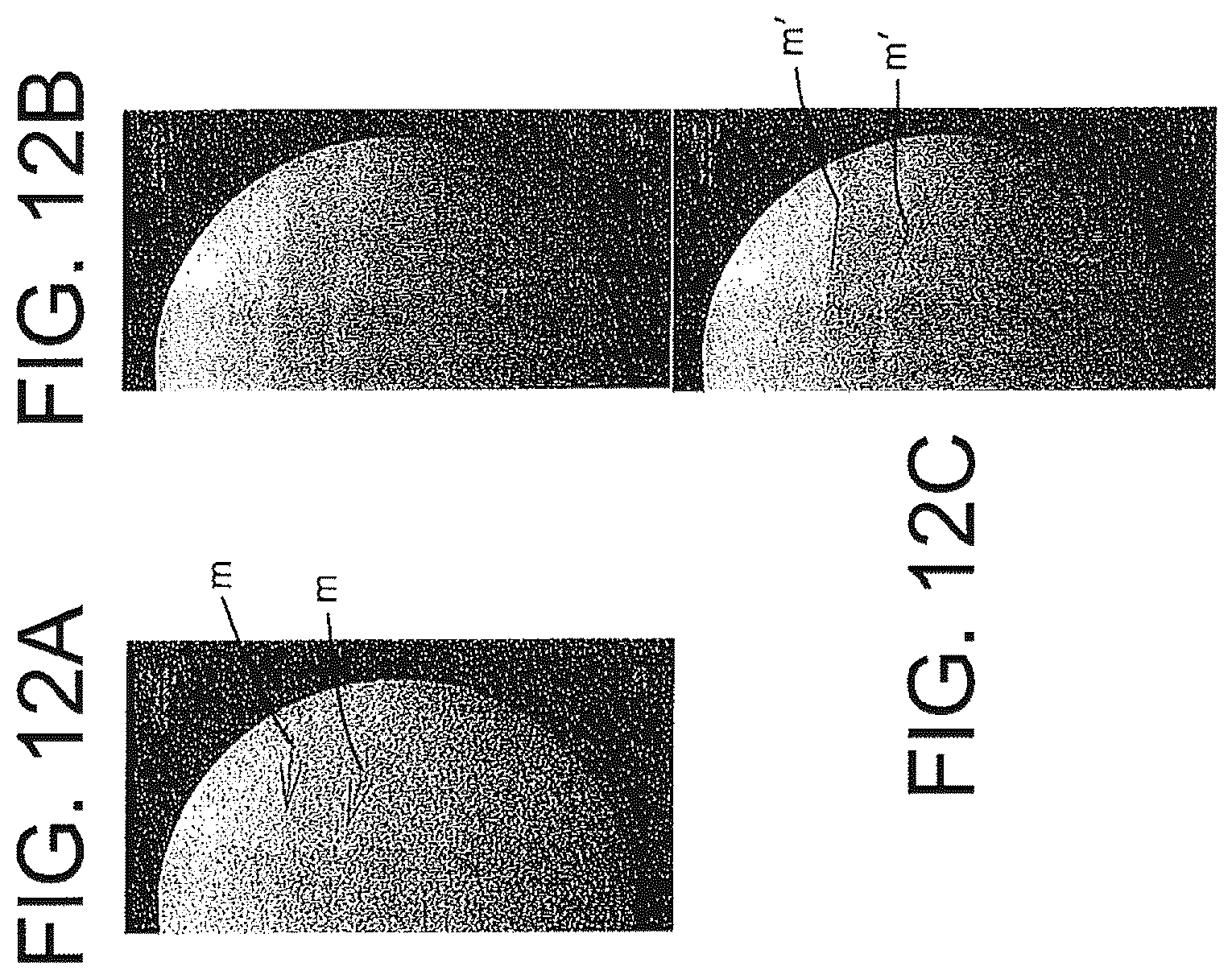 Patent US12508083 Figure 11 – System and method for image localization of effecters during a medical procedure