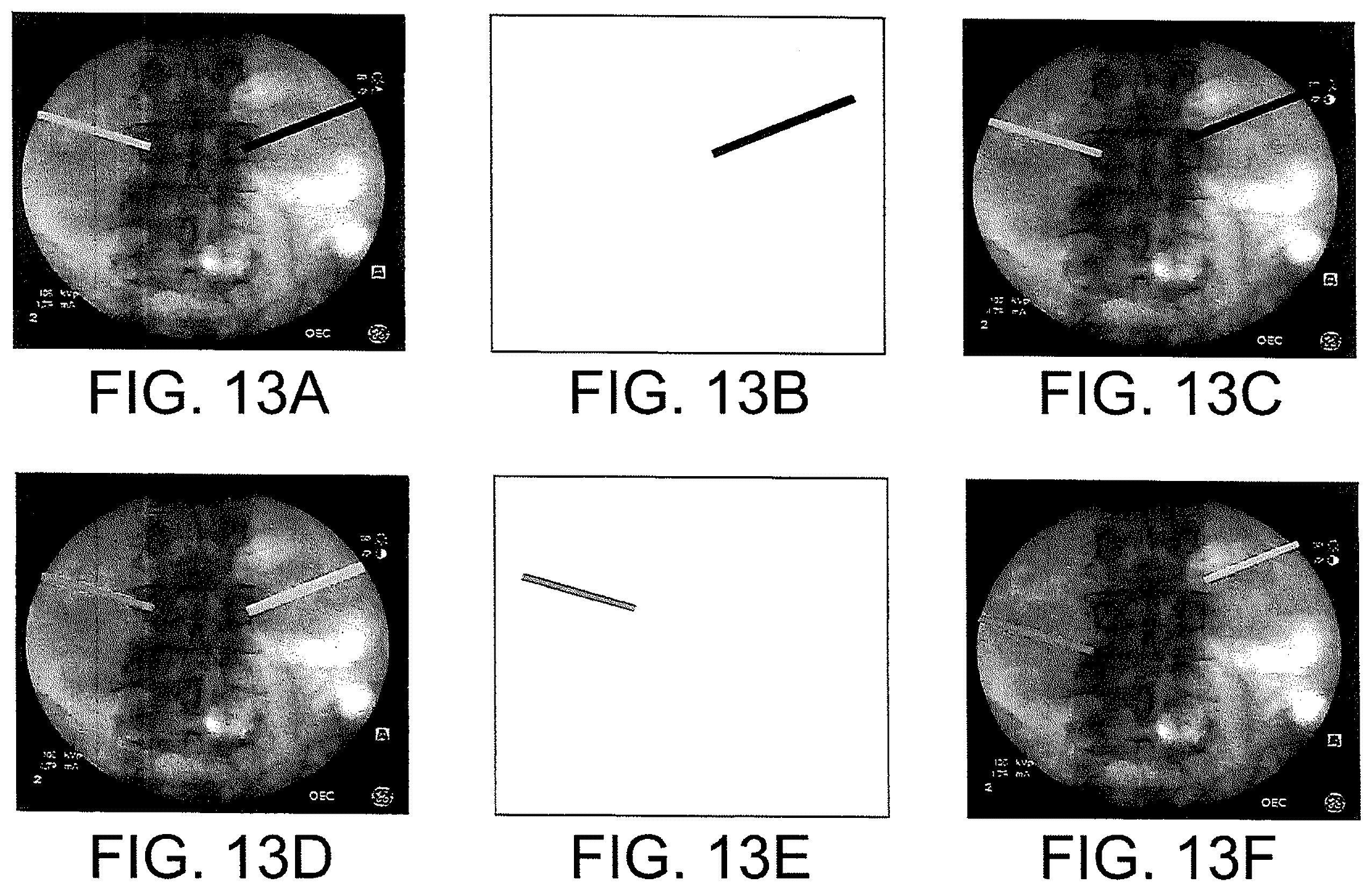 Patent US12508083 Figure 12 – System and method for image localization of effecters during a medical procedure