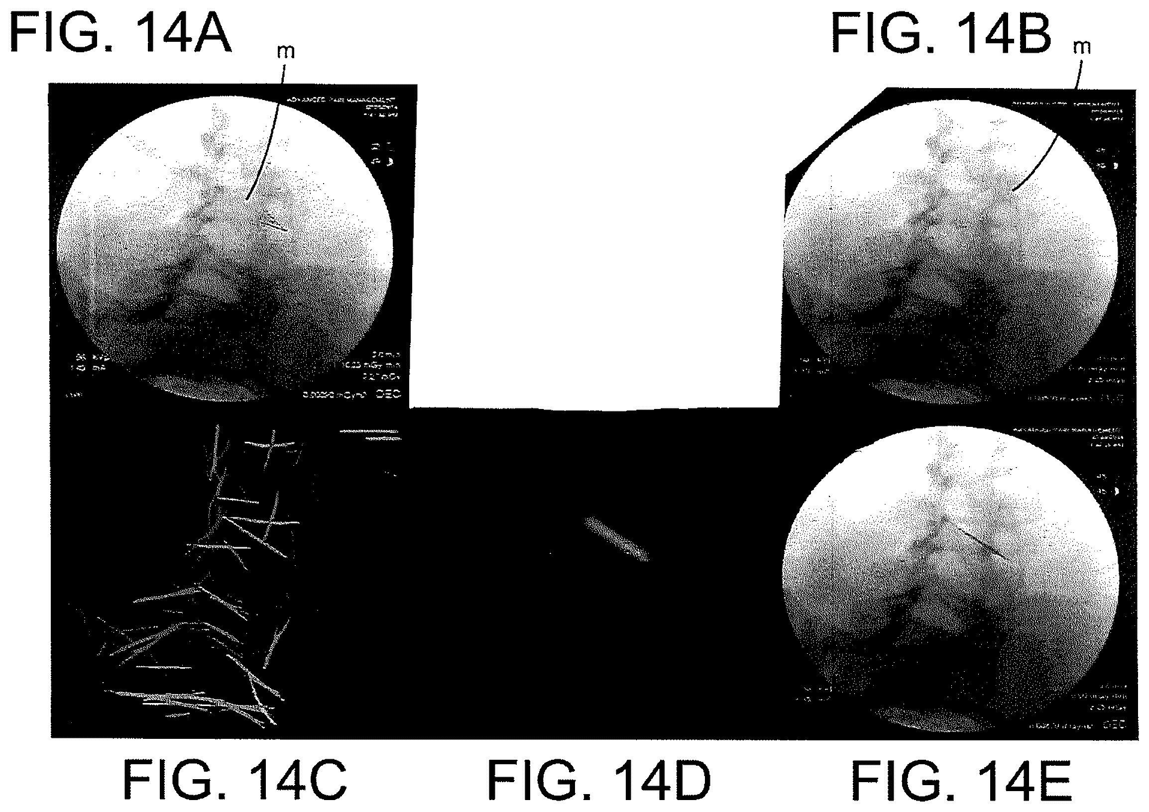 Patent US12508083 Figure 13 – System and method for image localization of effecters during a medical procedure