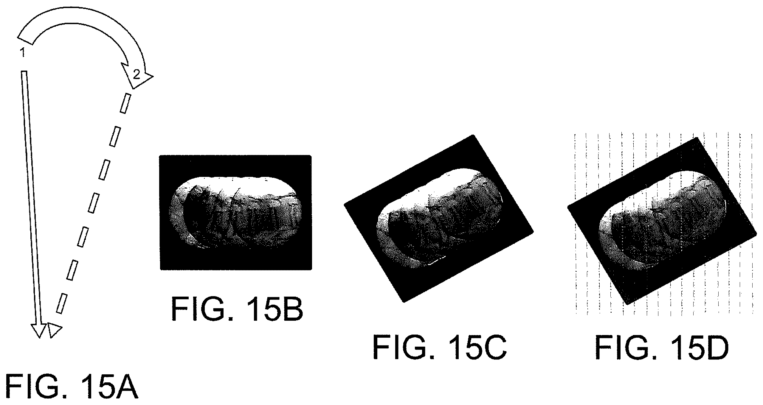 Patent US12508083 Figure 14 – System and method for image localization of effecters during a medical procedure