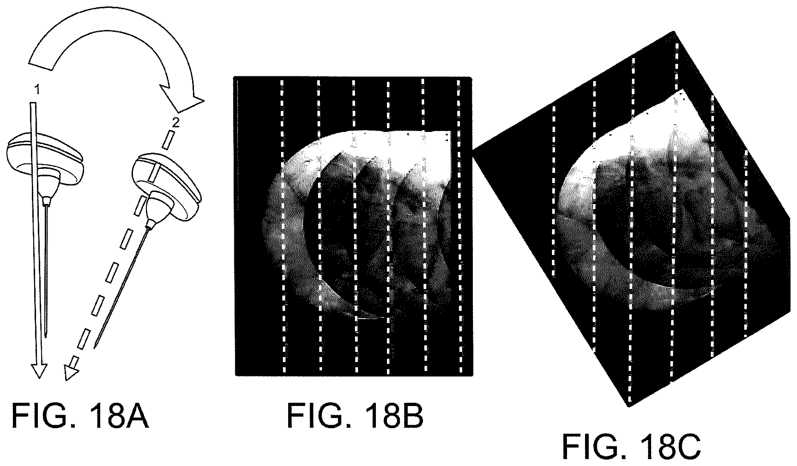 Patent US12508083 Figure 17 – System and method for image localization of effecters during a medical procedure