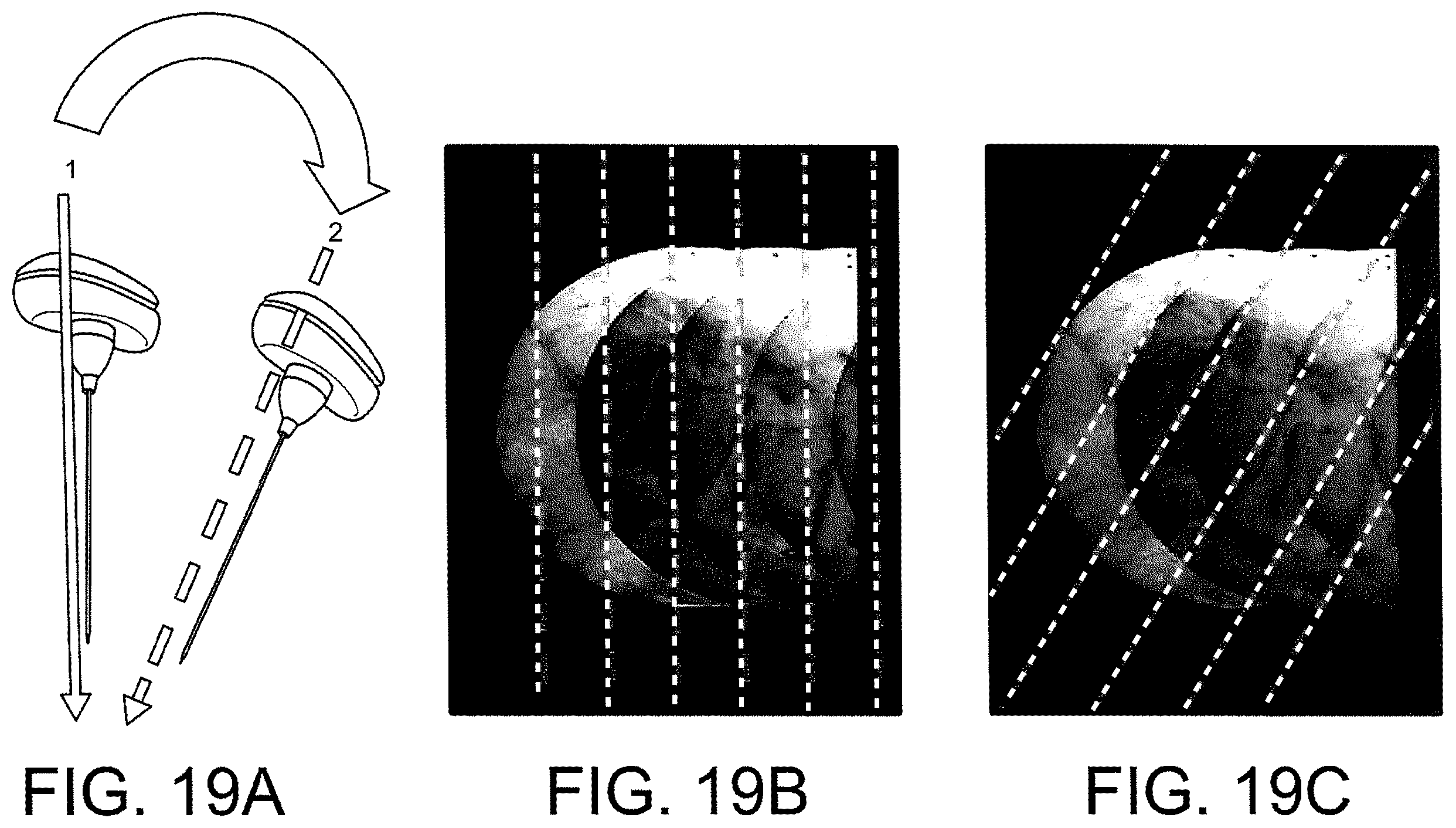 Patent US12508083 Figure 18 – System and method for image localization of effecters during a medical procedure